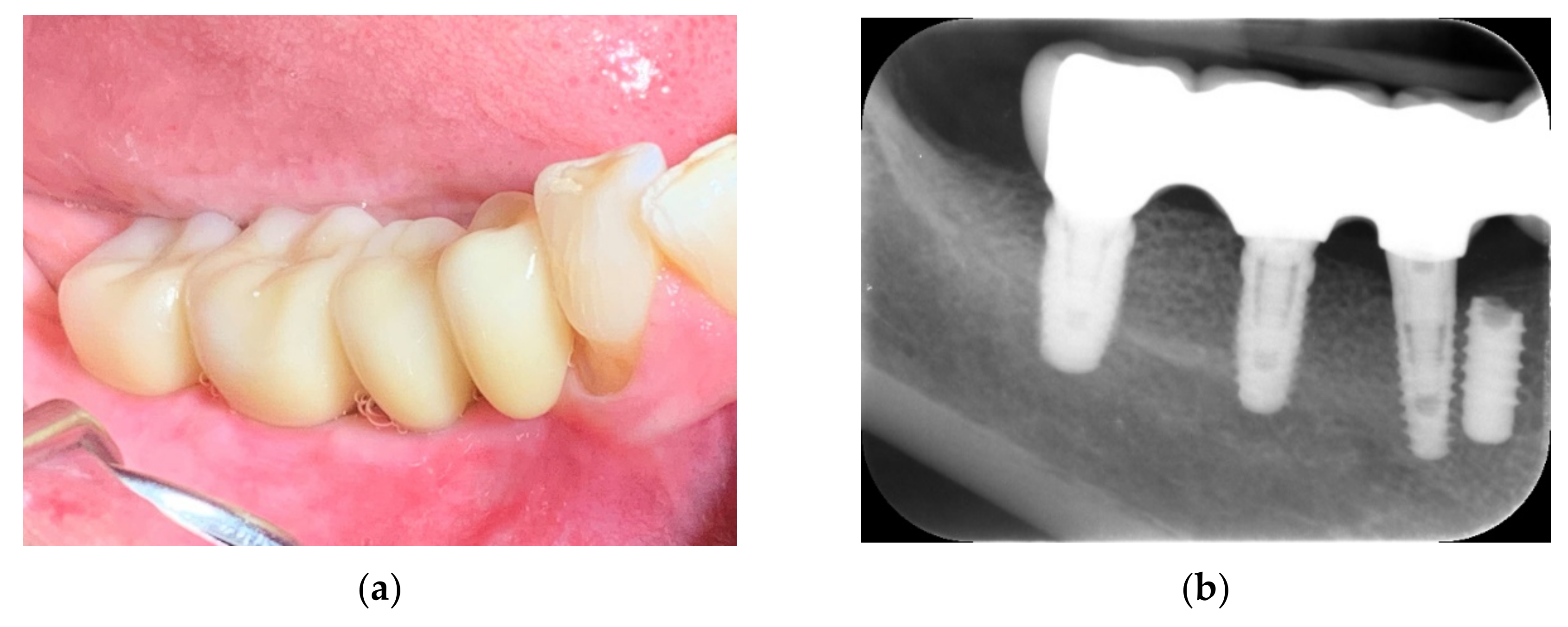 Applsci 11 10413 g020