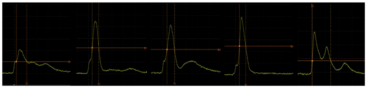 Applsci 11 10539 g005 Applsci 11 10539 g005