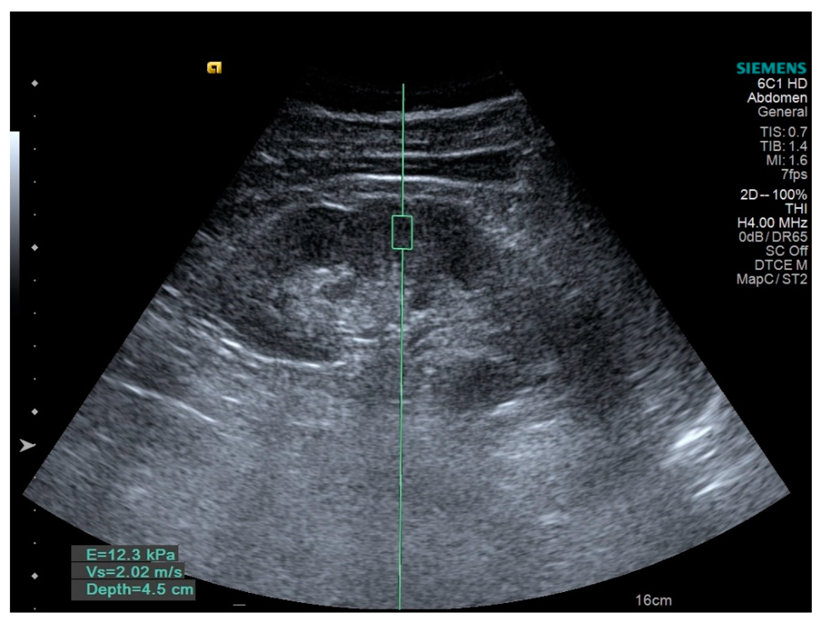 Applsci 11 10612 g002