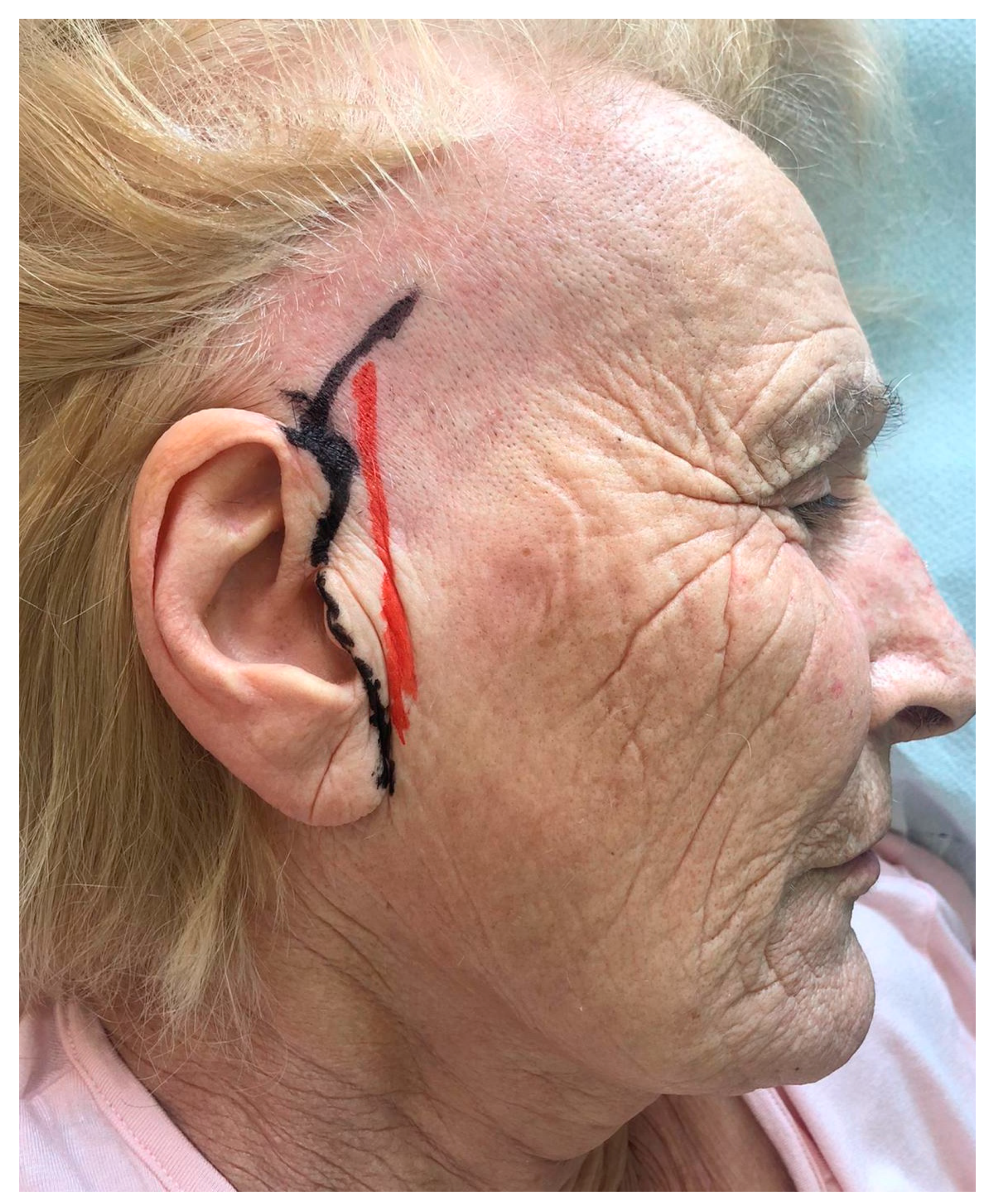 Applsci 11 10739 g001