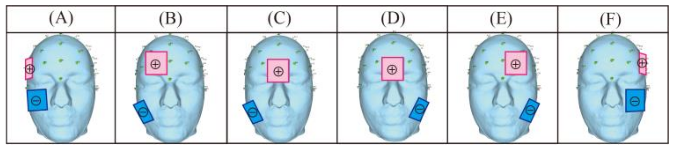 Applsci 11 10972 g002