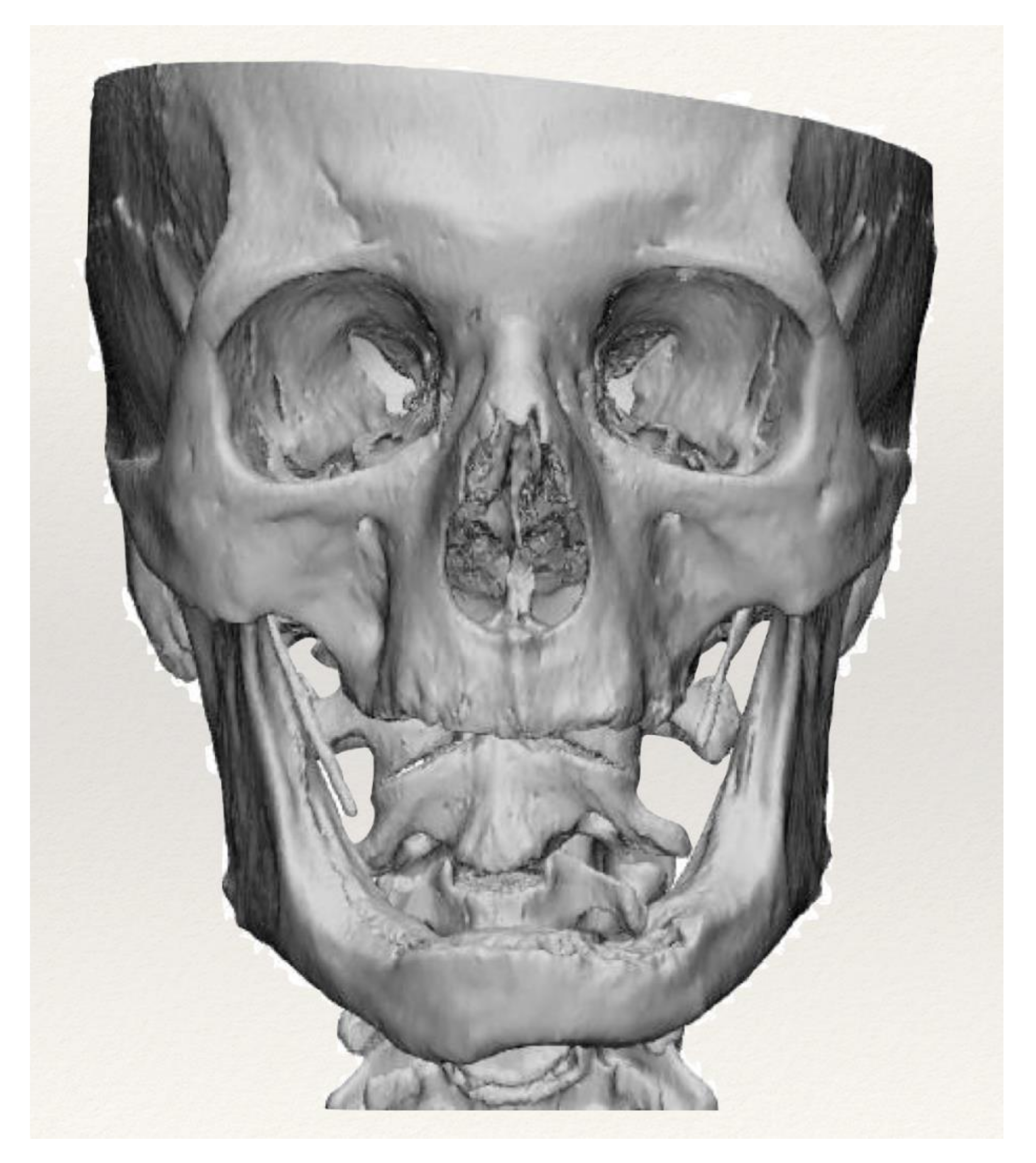 Applsci 11 11069 g001