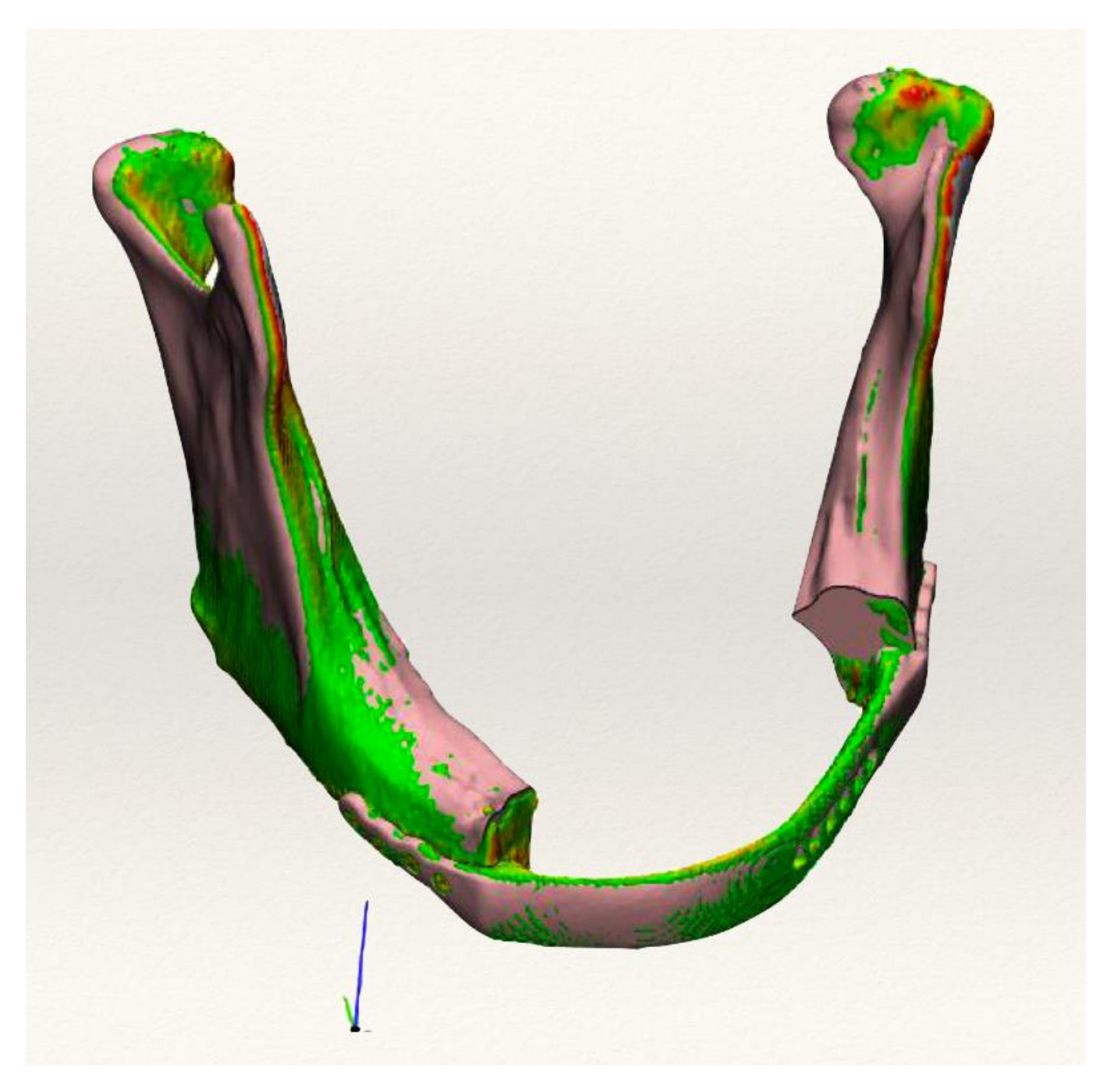 Applsci 11 11069 g004