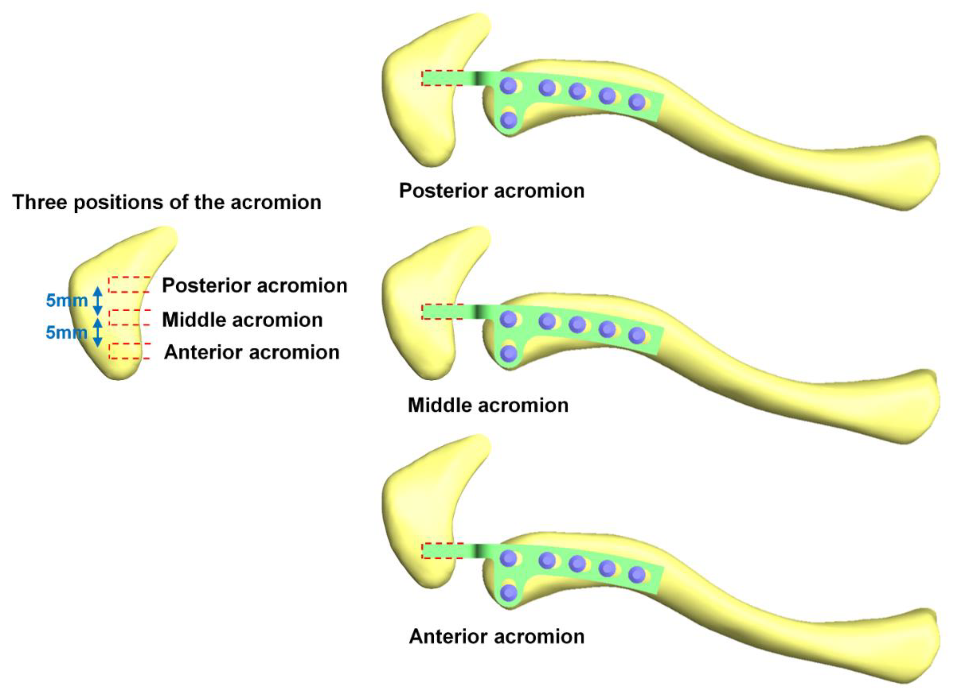 Applsci 11 11105 g003
