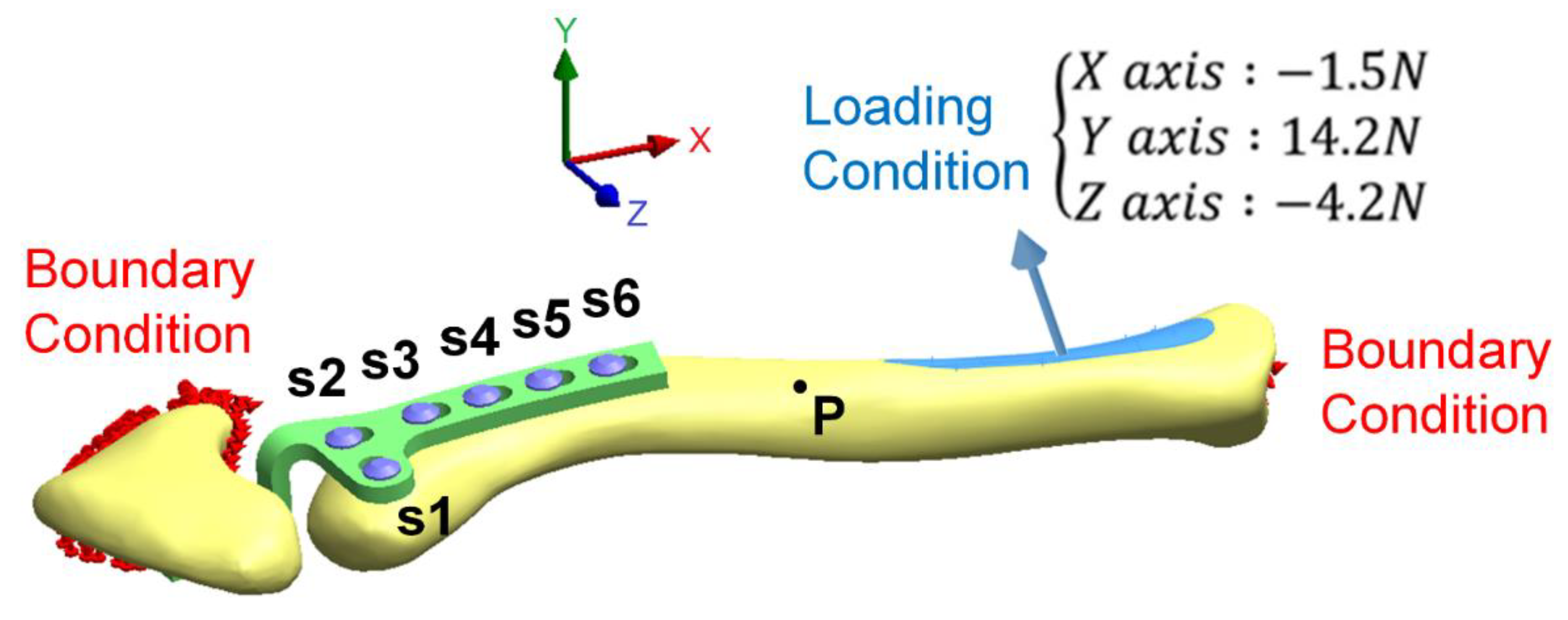 Applsci 11 11105 g004