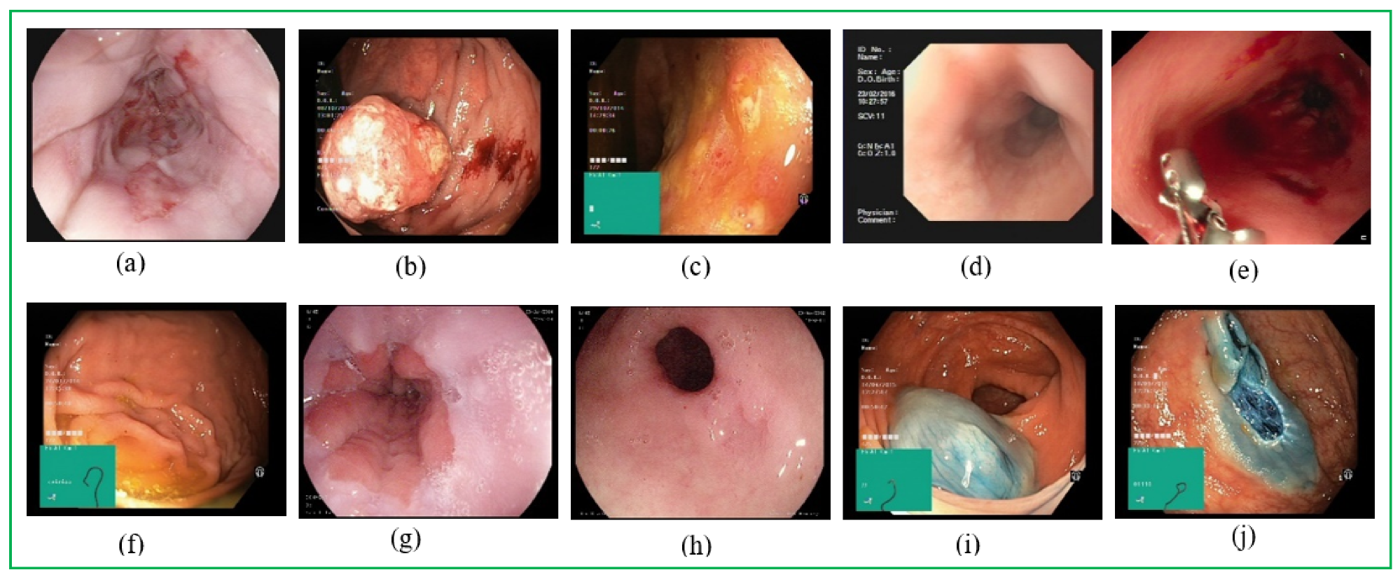 Applsci 11 11136 g001