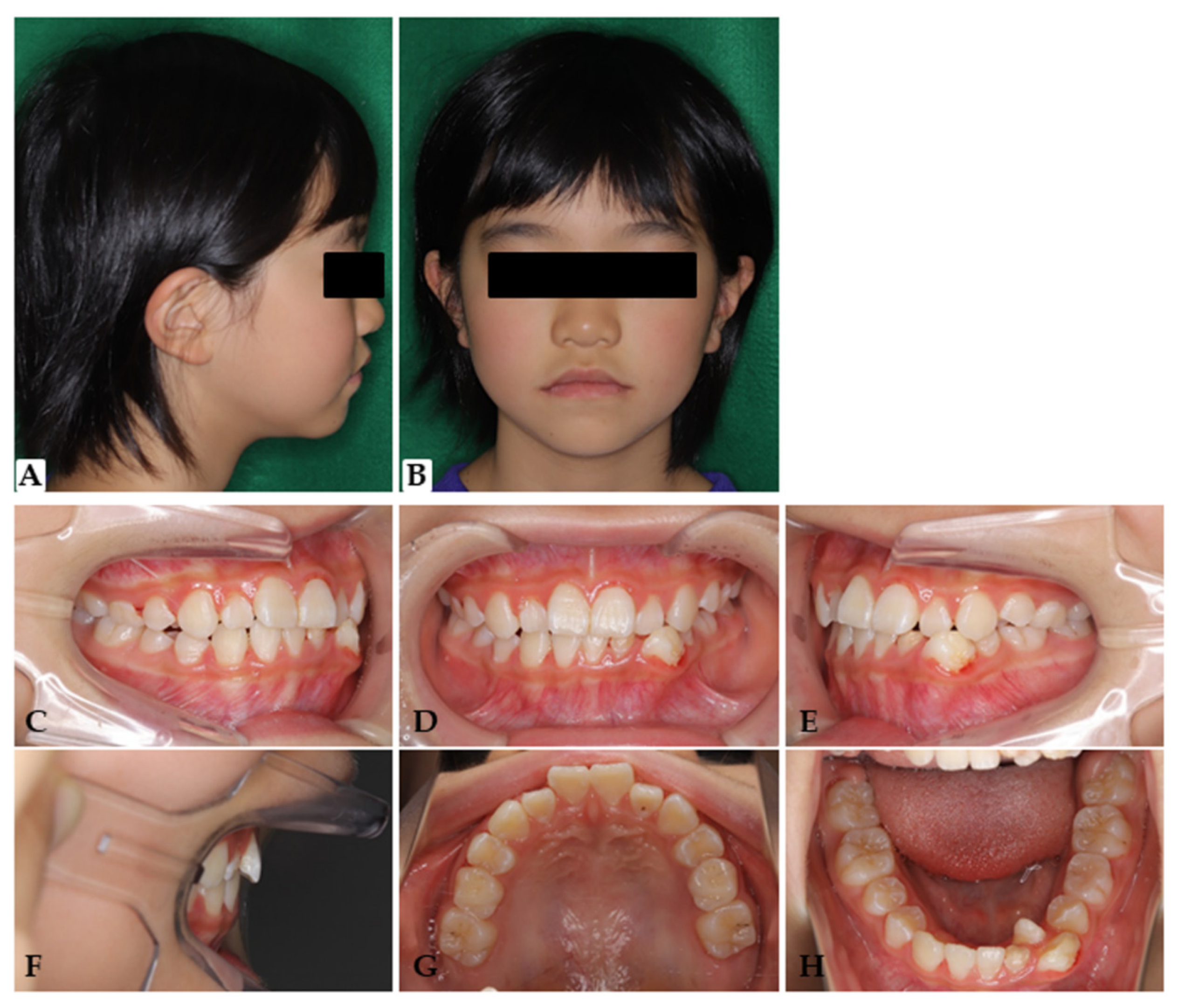 Applsci 11 11541 g005