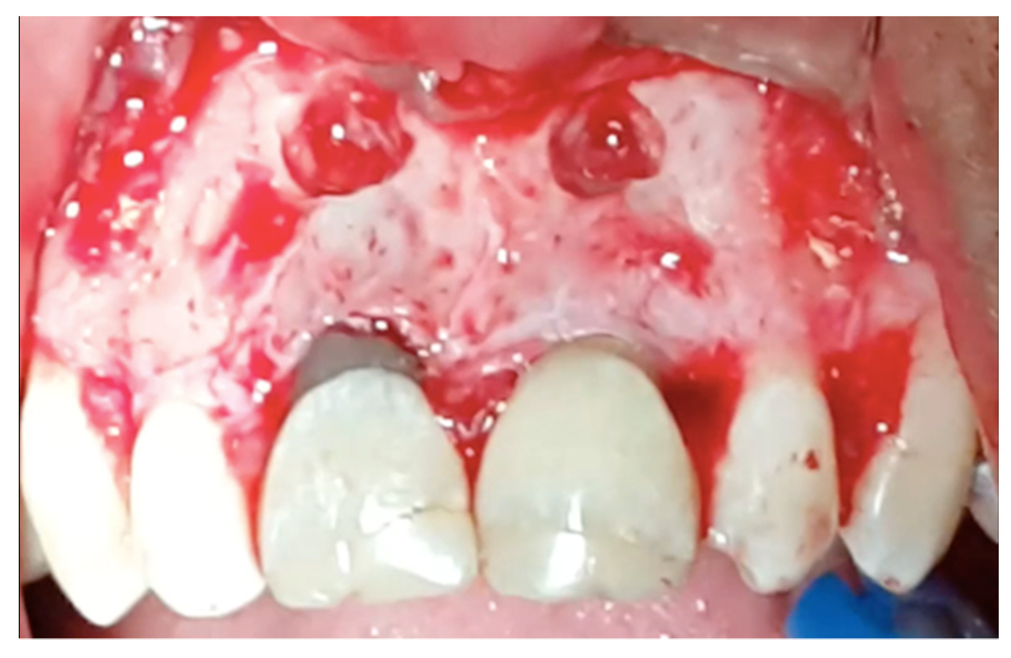 Applsci 11 11768 g002