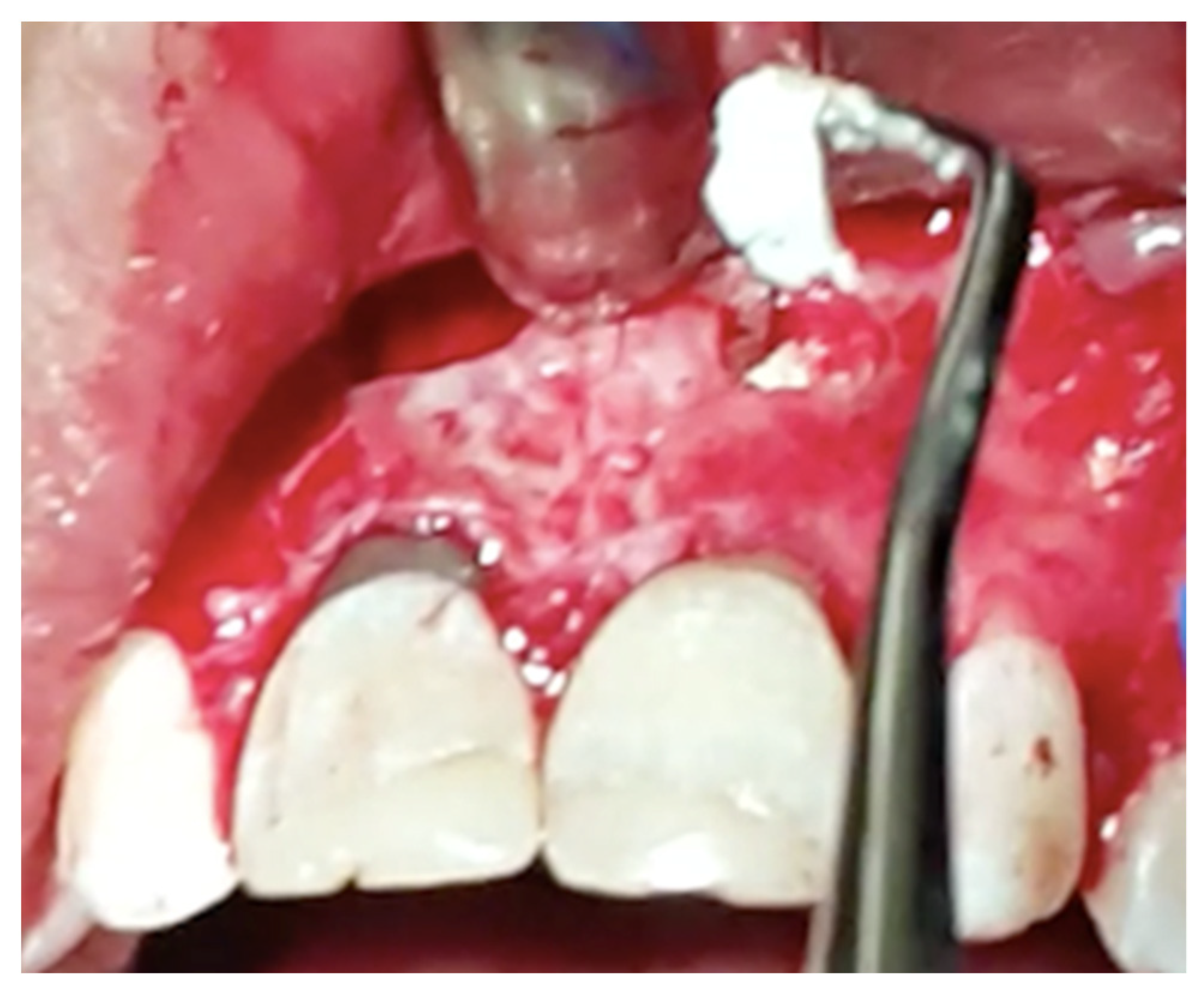 Applsci 11 11768 g004