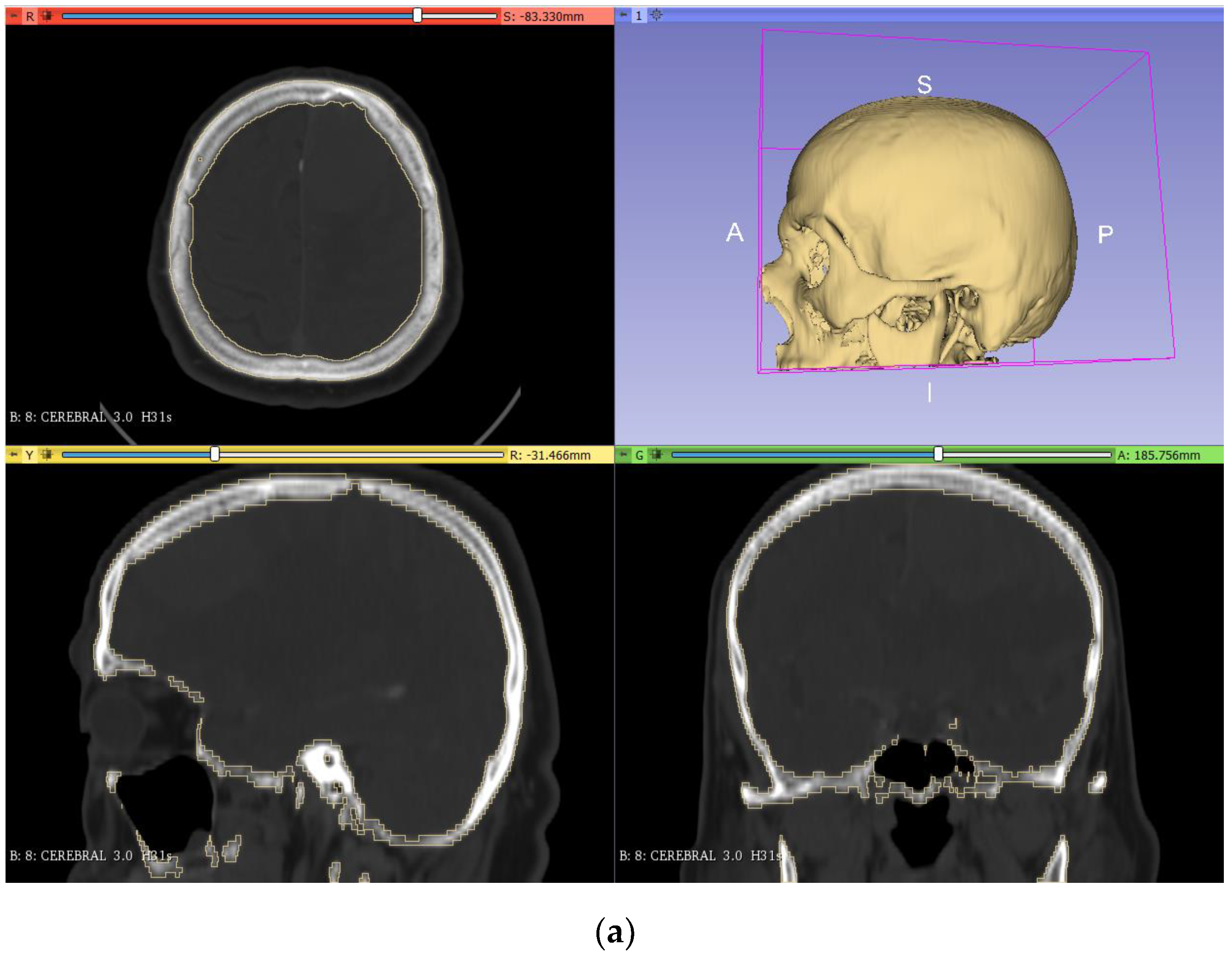 Applsci 11 11823 g002a