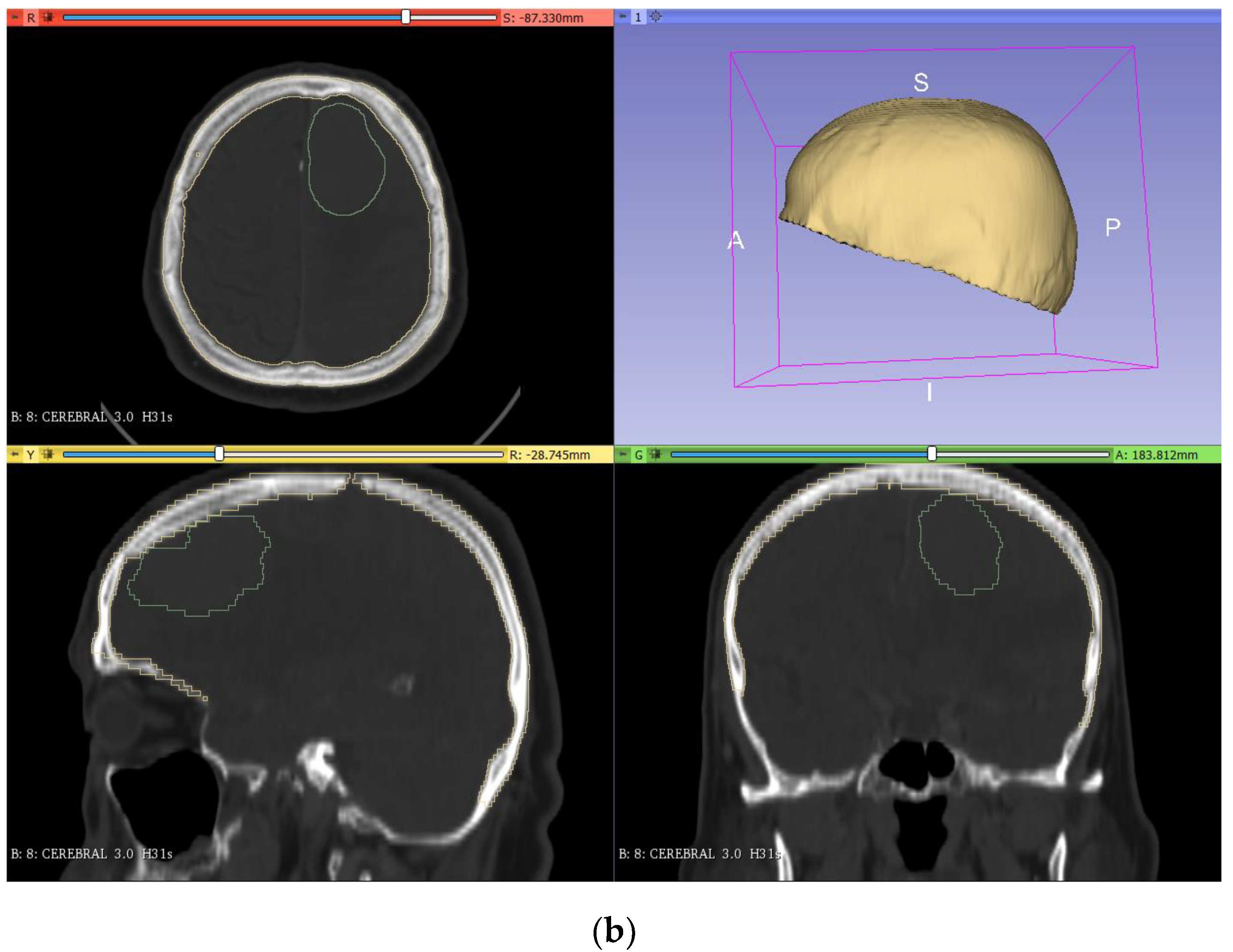 Applsci 11 11823 g002b