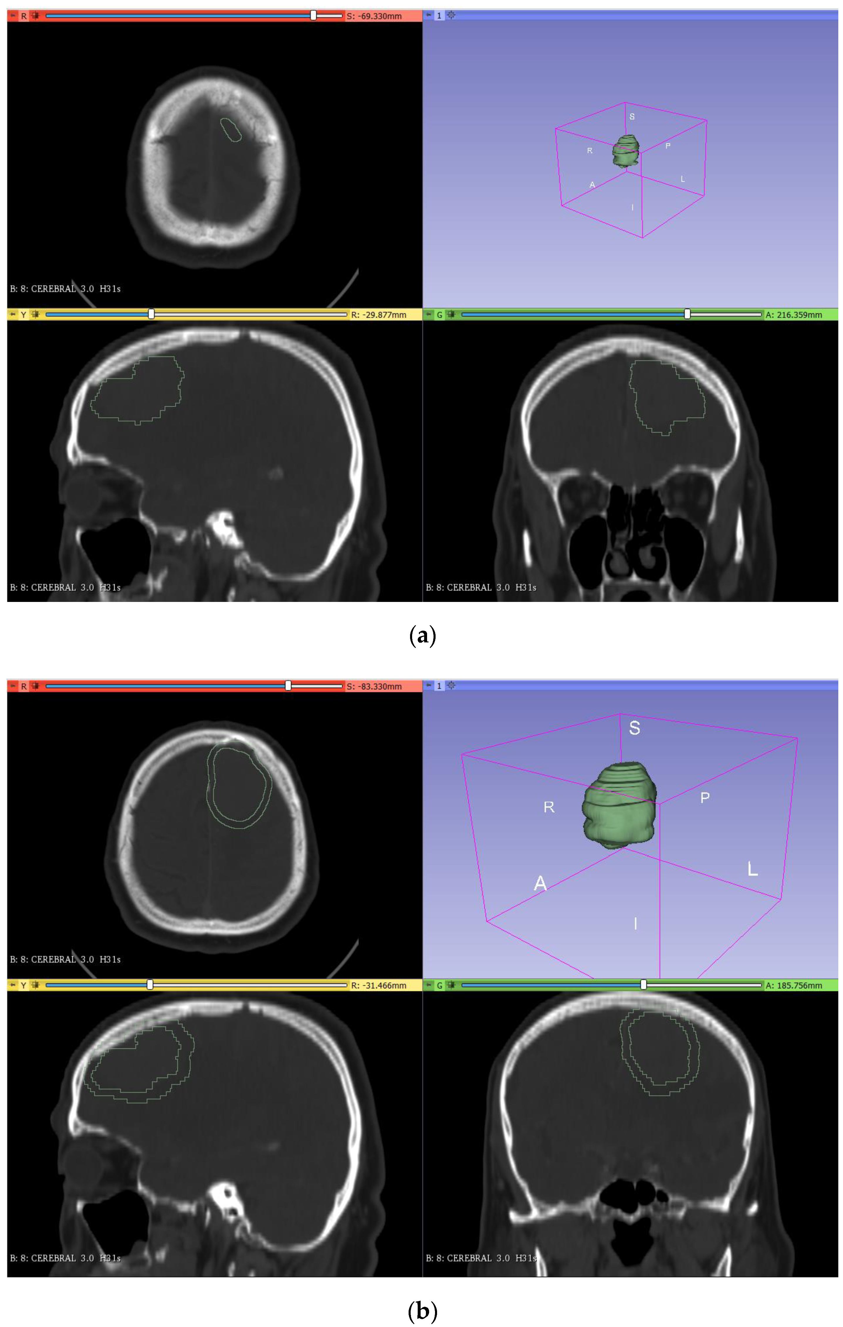 Applsci 11 11823 g003
