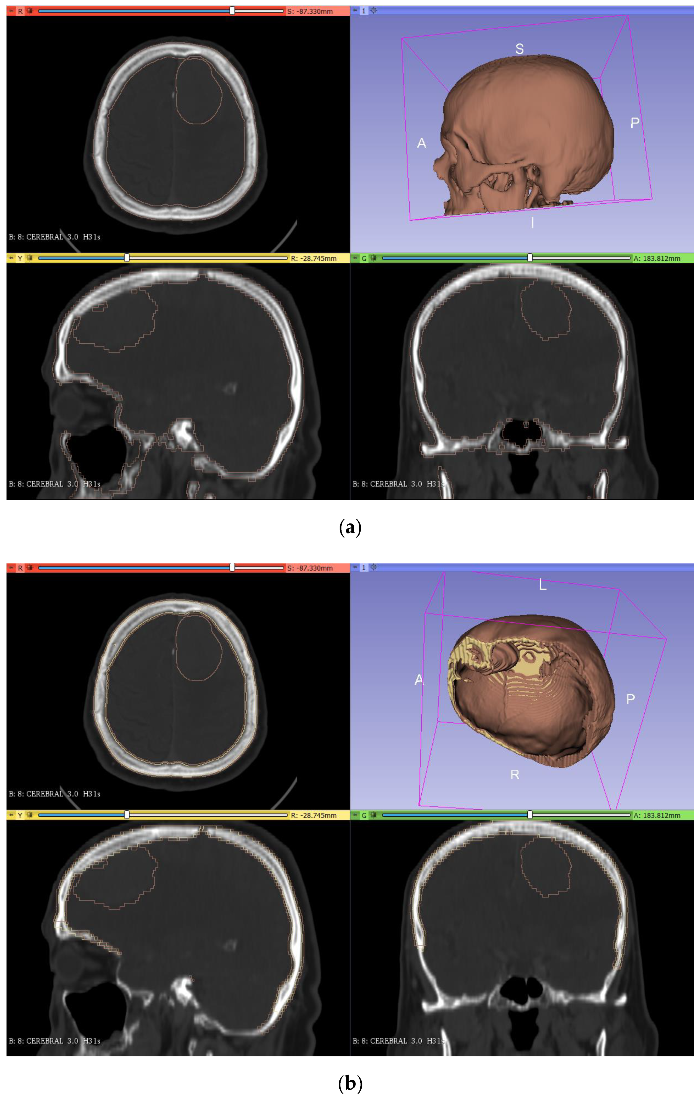 Applsci 11 11823 g004