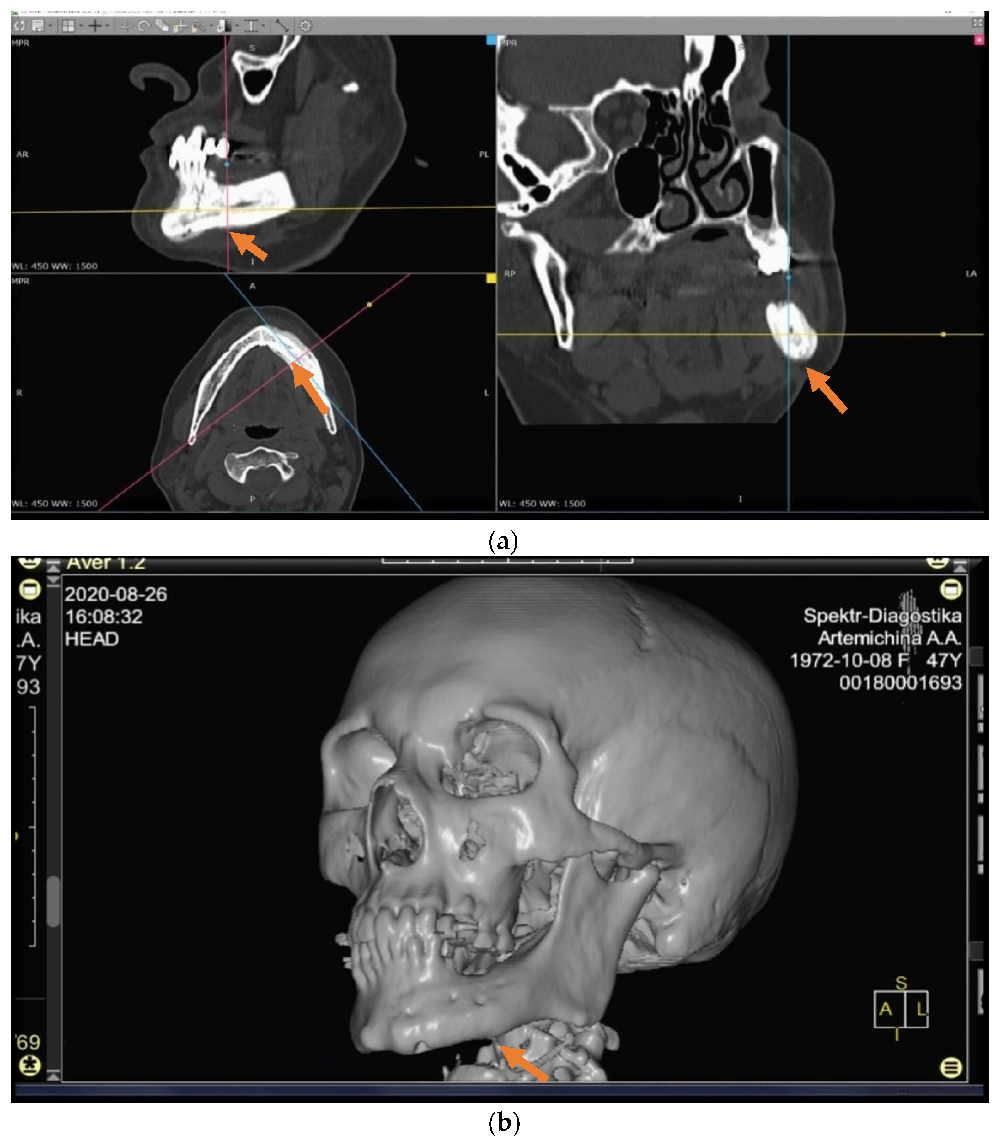 Applsci 11 11950 g003