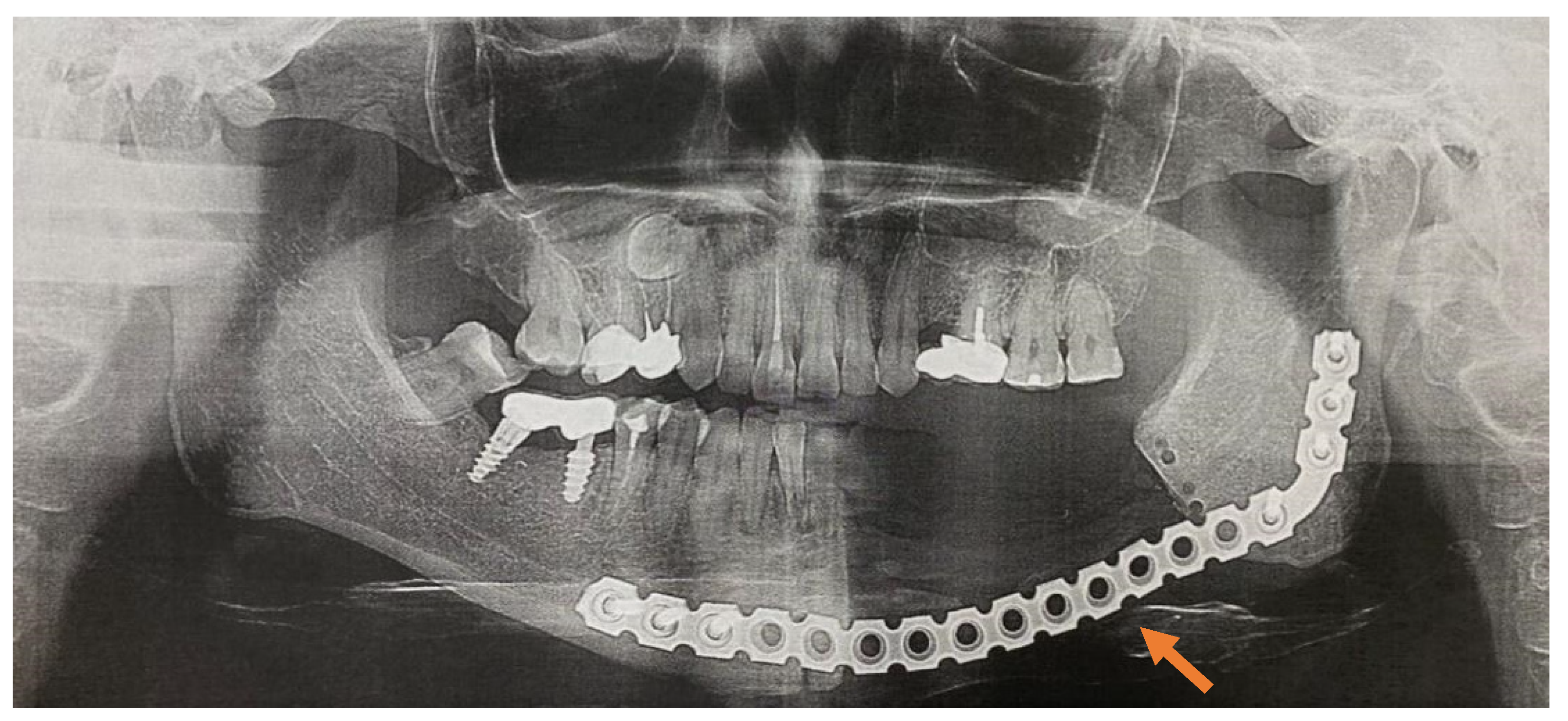 Applsci 11 11950 g006