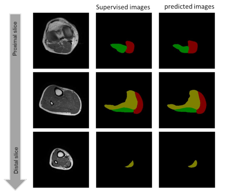 Applsci 11 12006 g006