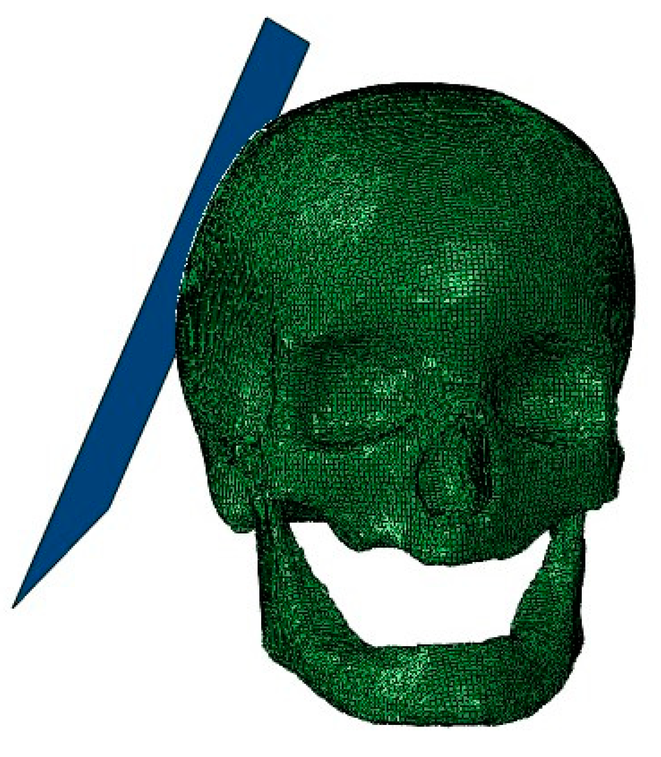 Applsci 12 00878 g003