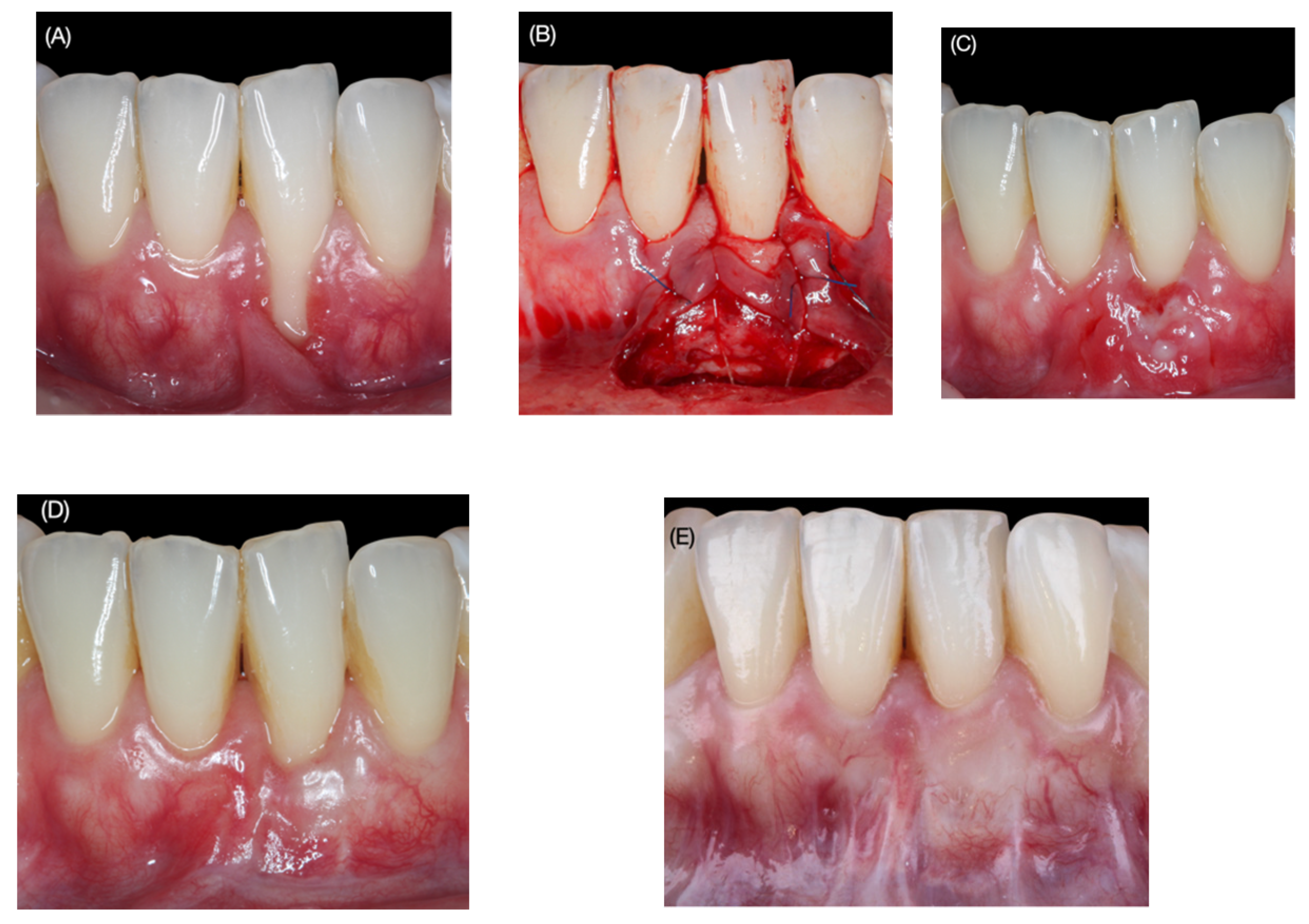 Applsci 12 01038 g003