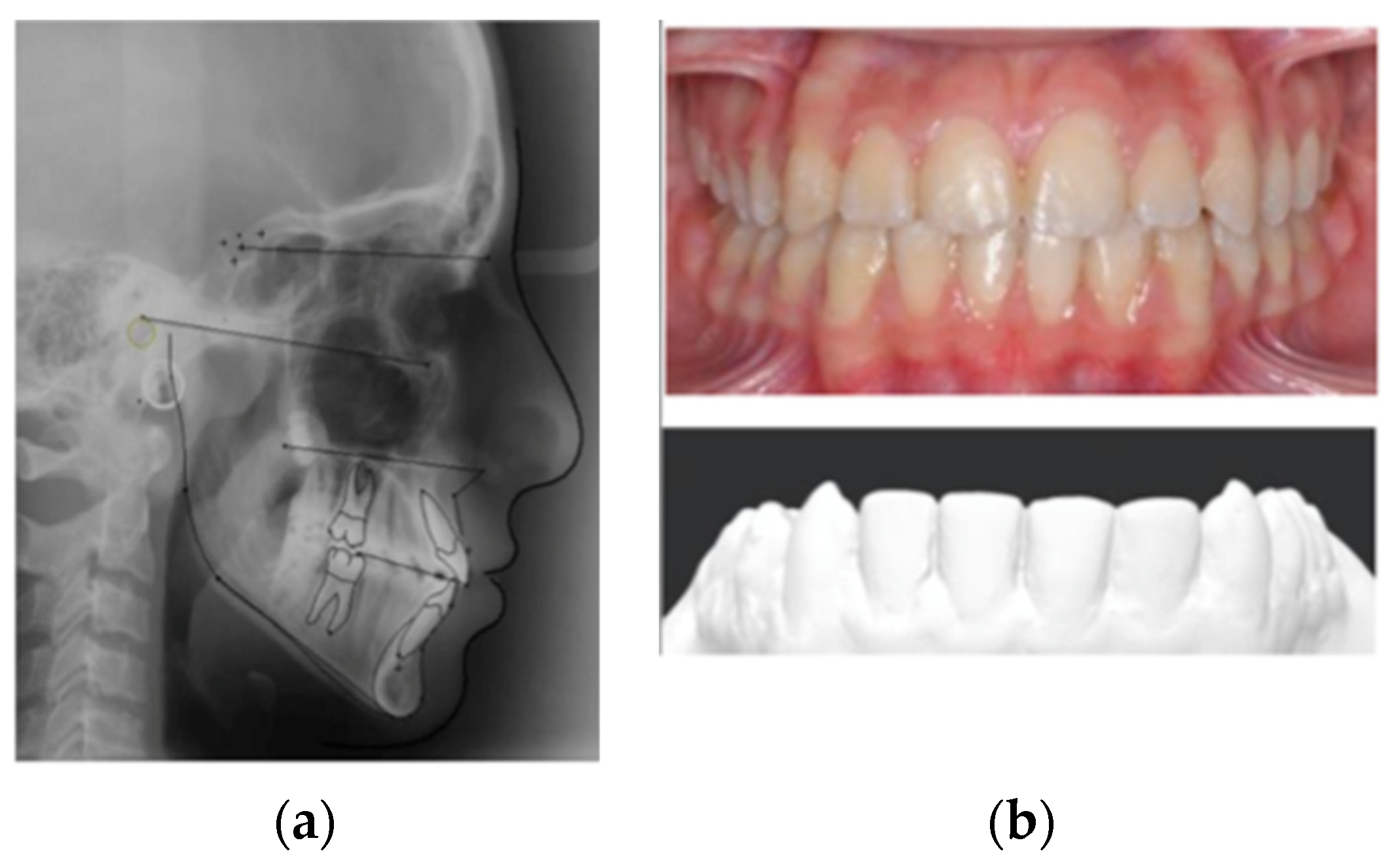 Applsci 12 01641 g001