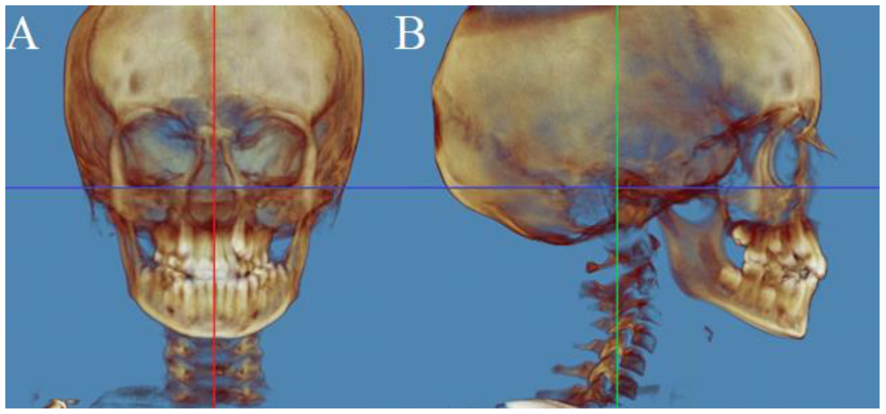Applsci 12 02221 g001