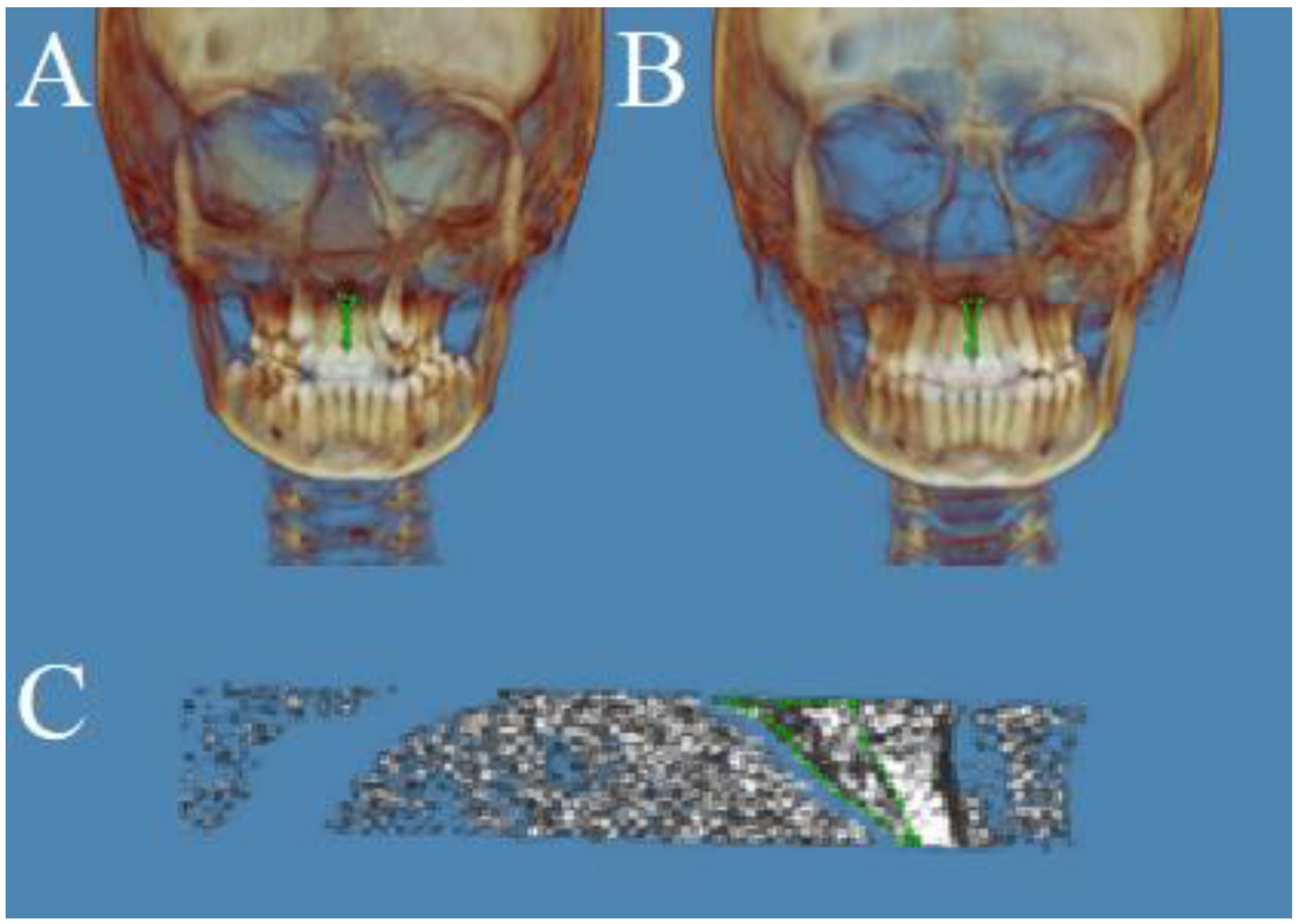 Applsci 12 02221 g002