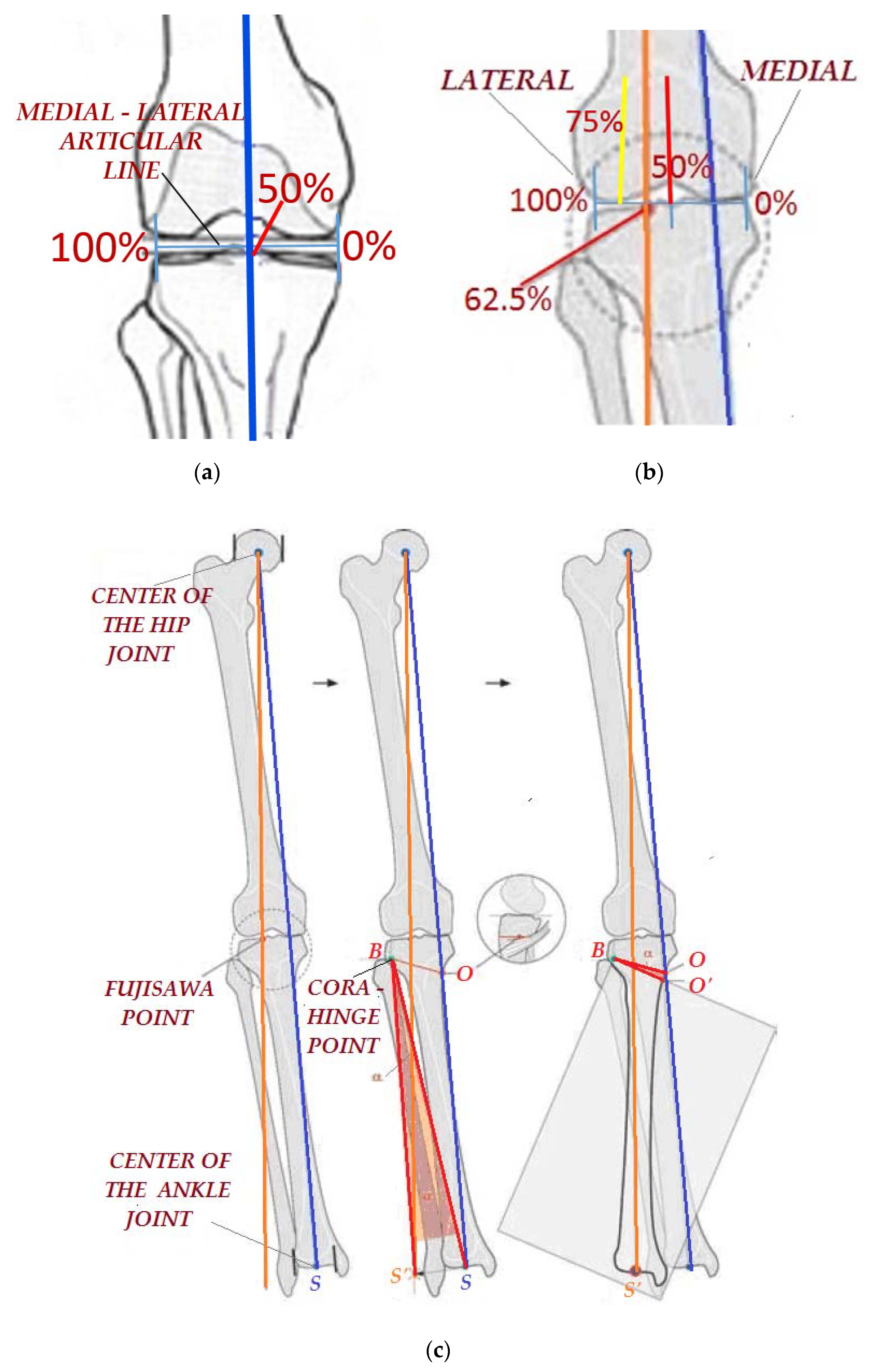 Applsci 12 02475 g001
