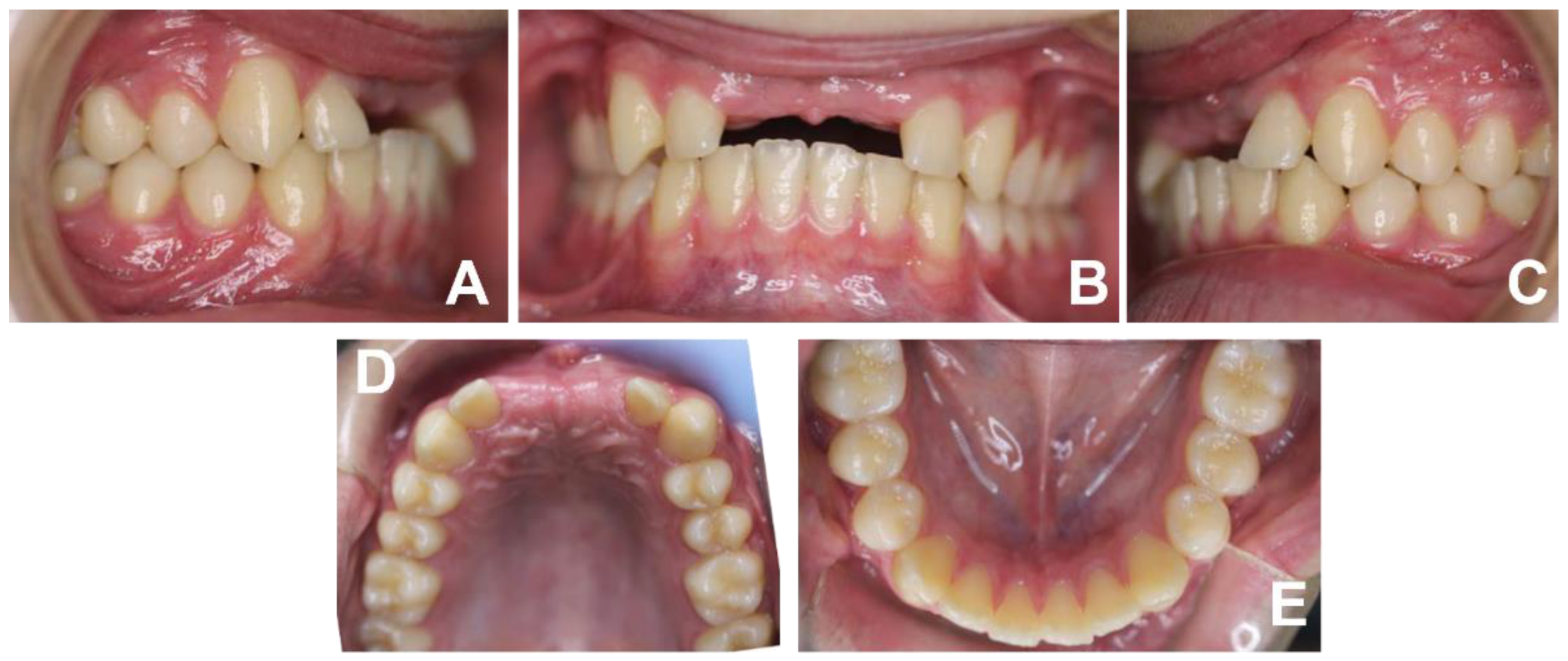 Applsci 12 02657 g004