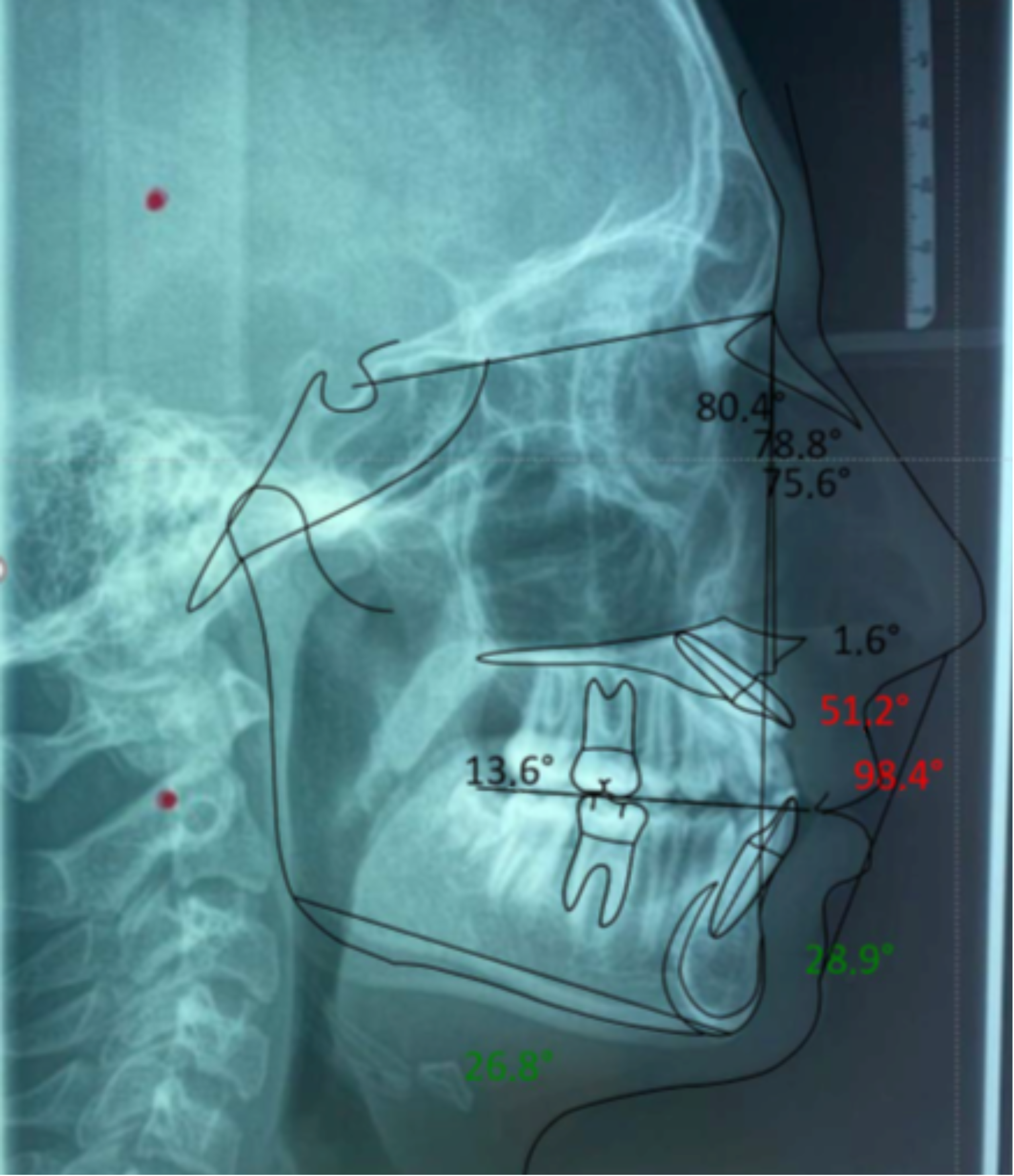 Applsci 12 02657 g006