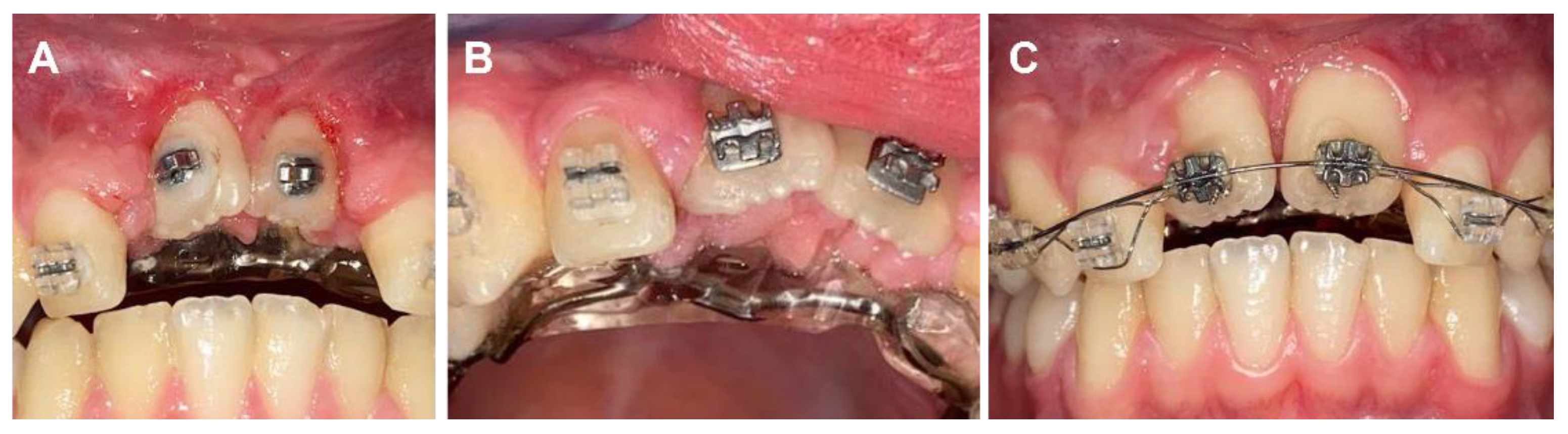 Applsci 12 02657 g010