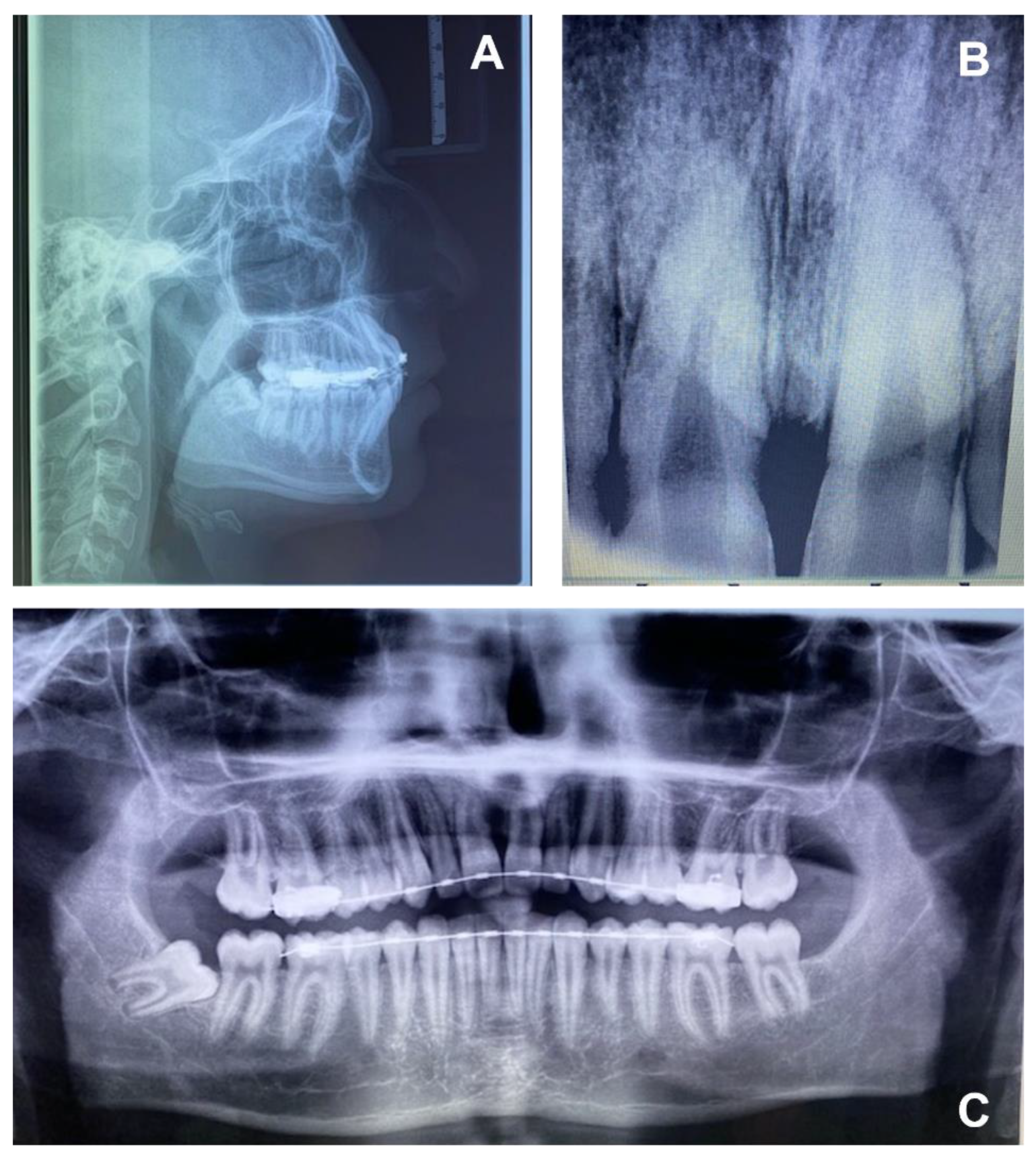 Applsci 12 02657 g011