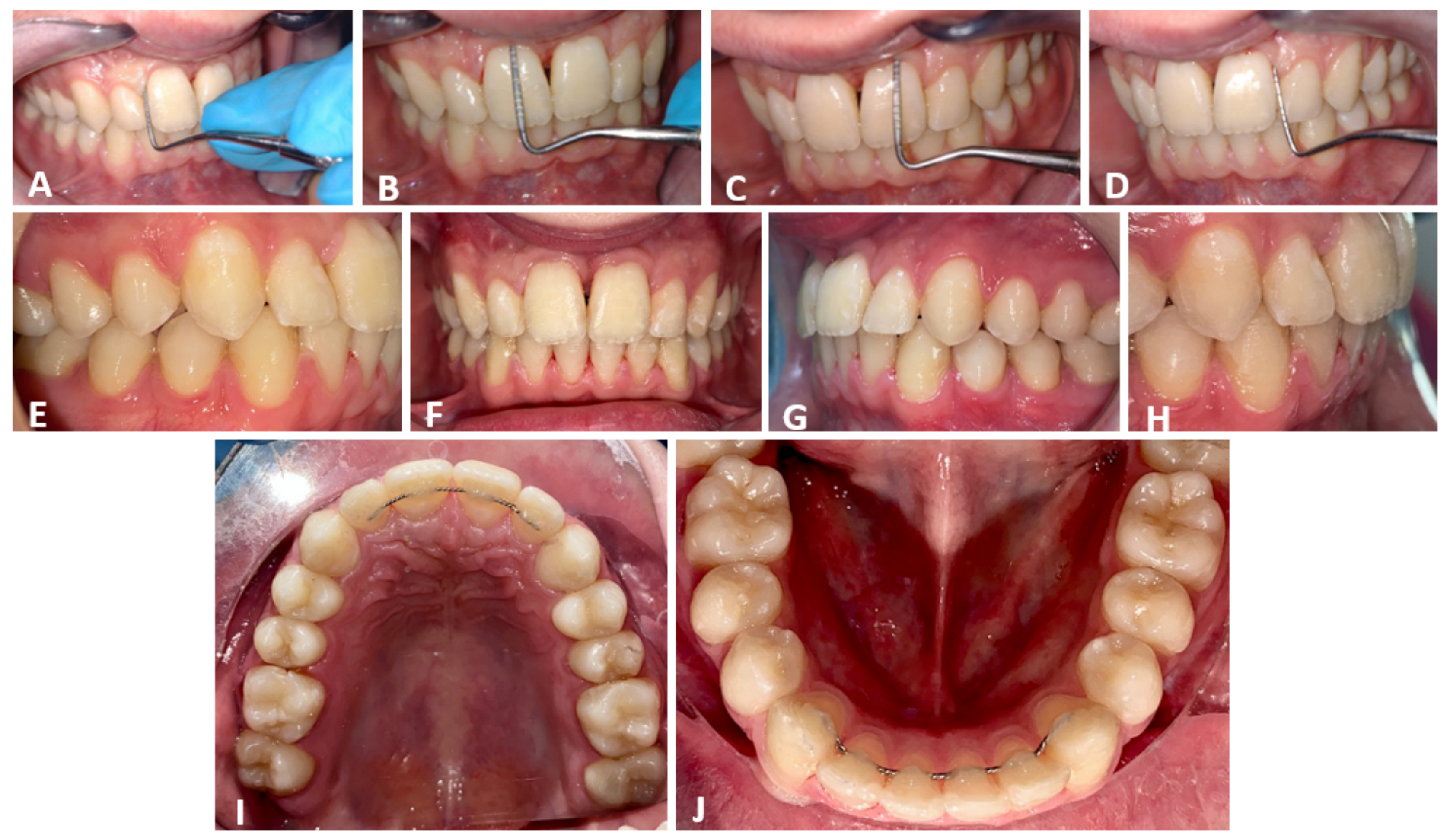 Applsci 12 02657 g012