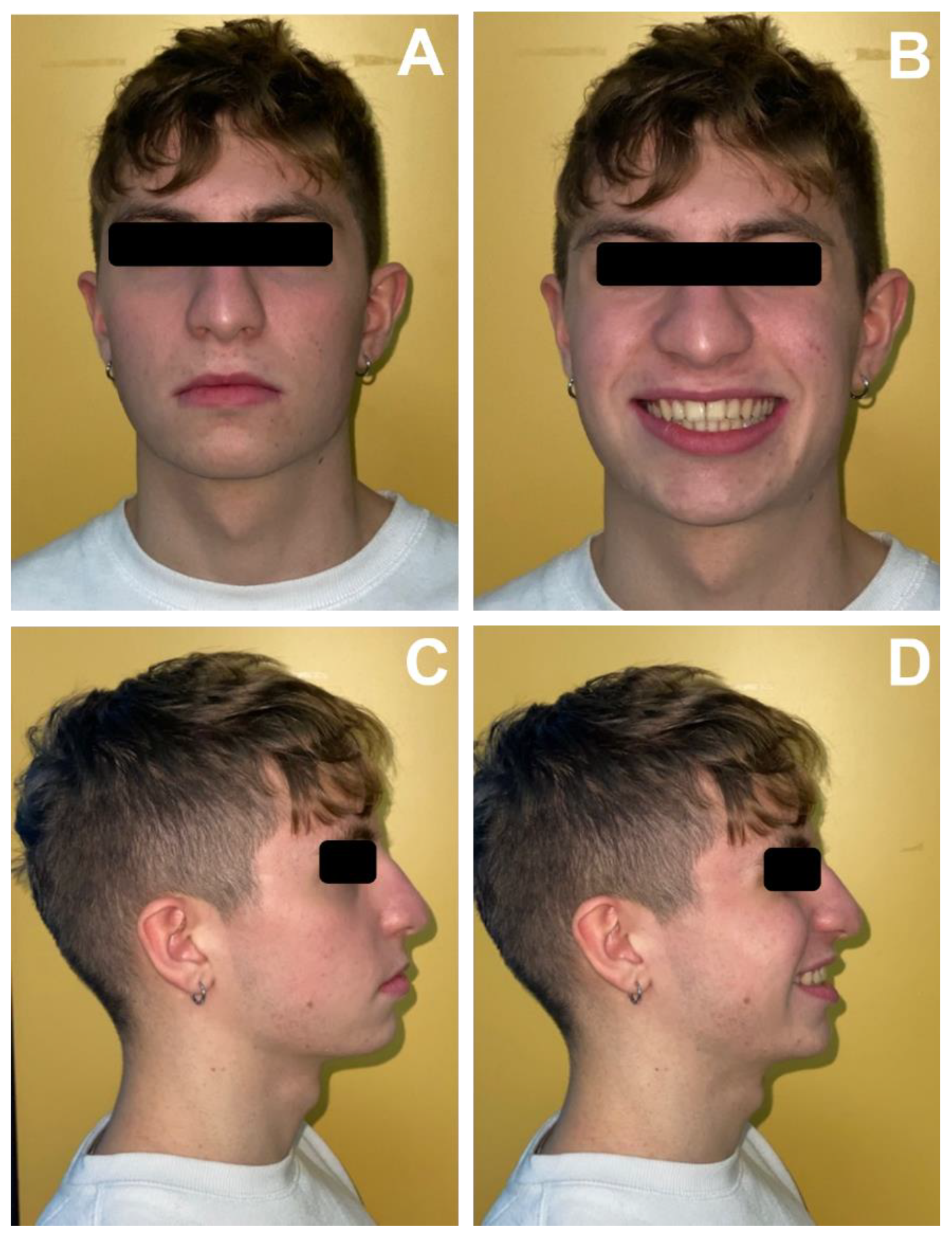 Applsci 12 02657 g013