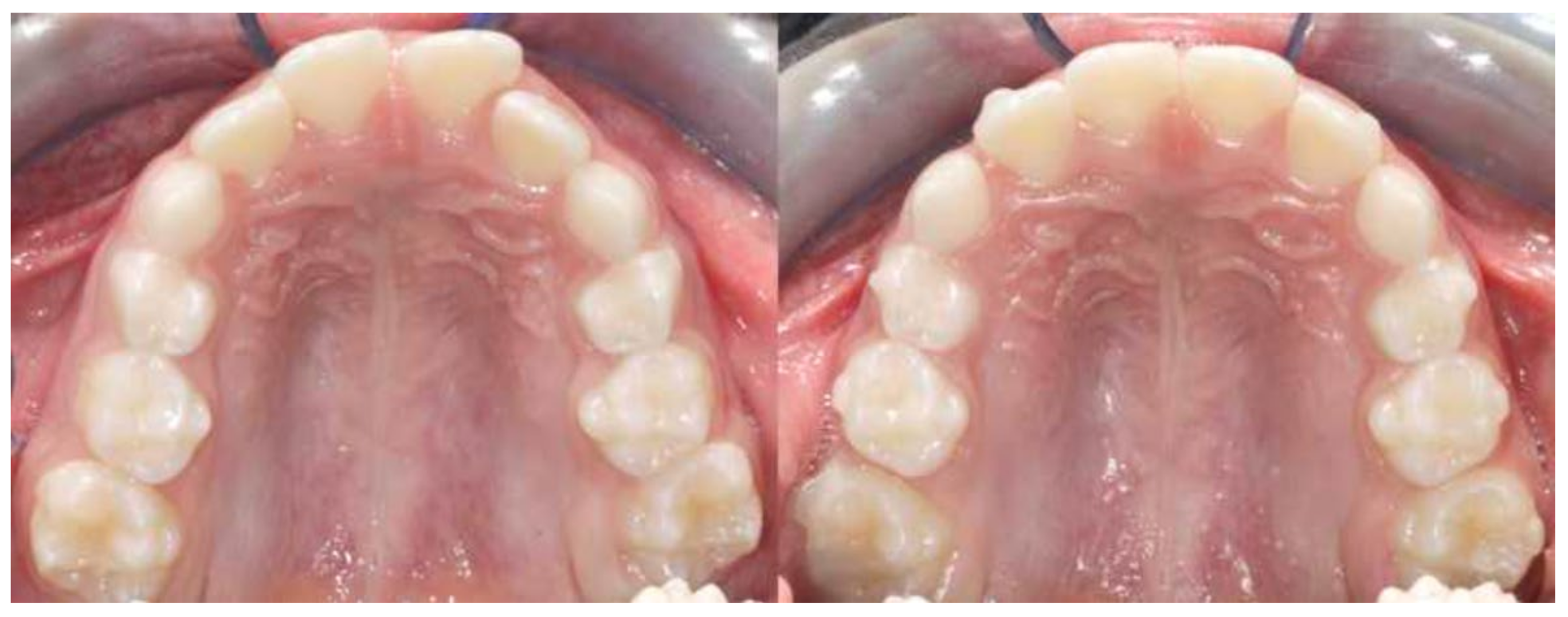 Applsci 12 02670 g003