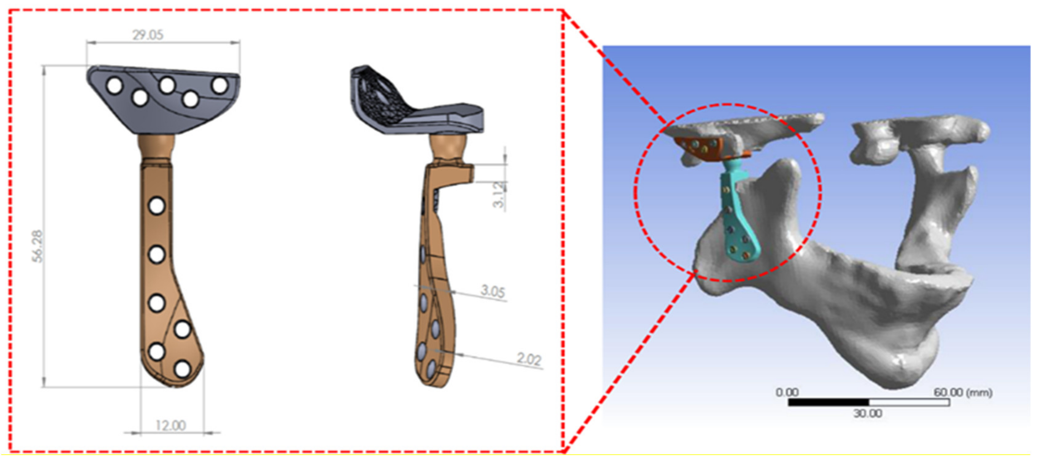 Applsci 12 03003 g003