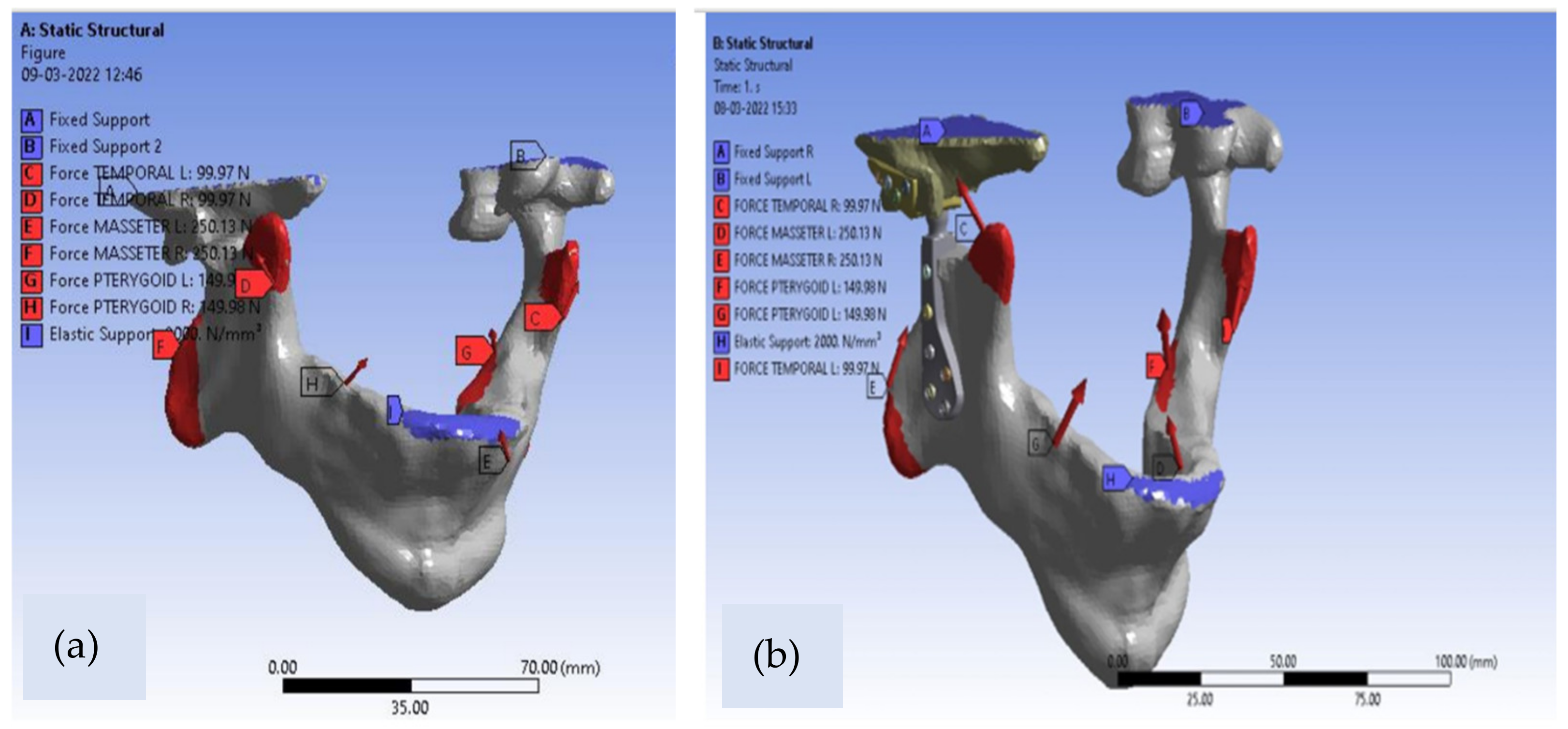 Applsci 12 03003 g004