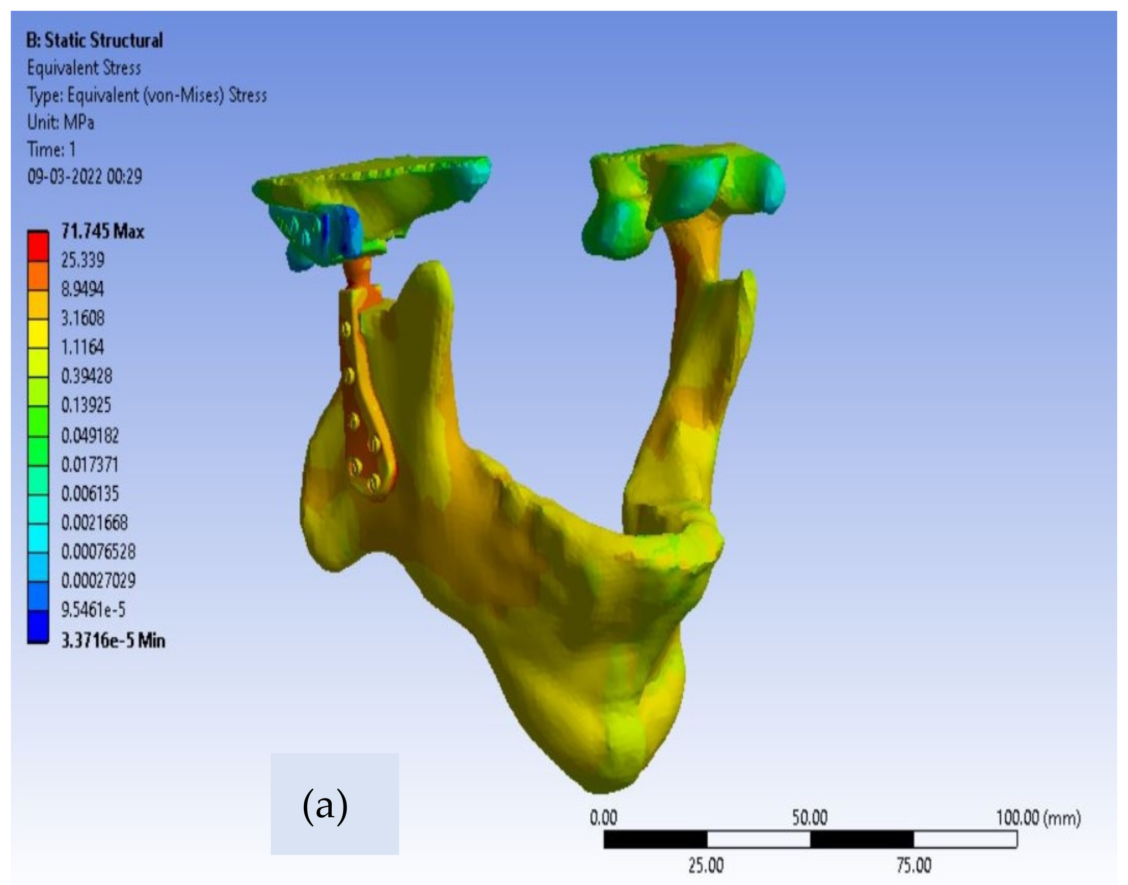 Applsci 12 03003 g007a