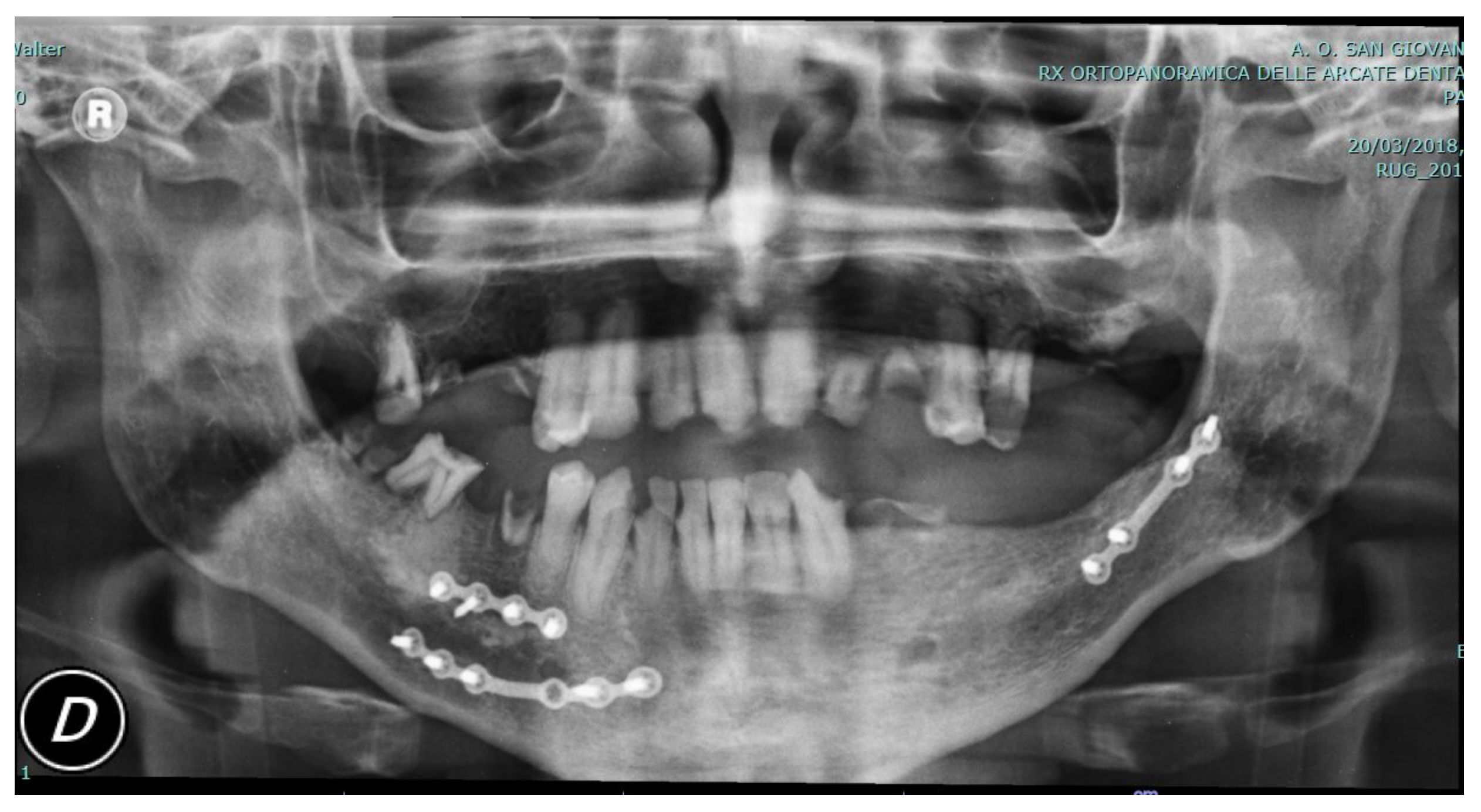 Applsci 12 03600 g006