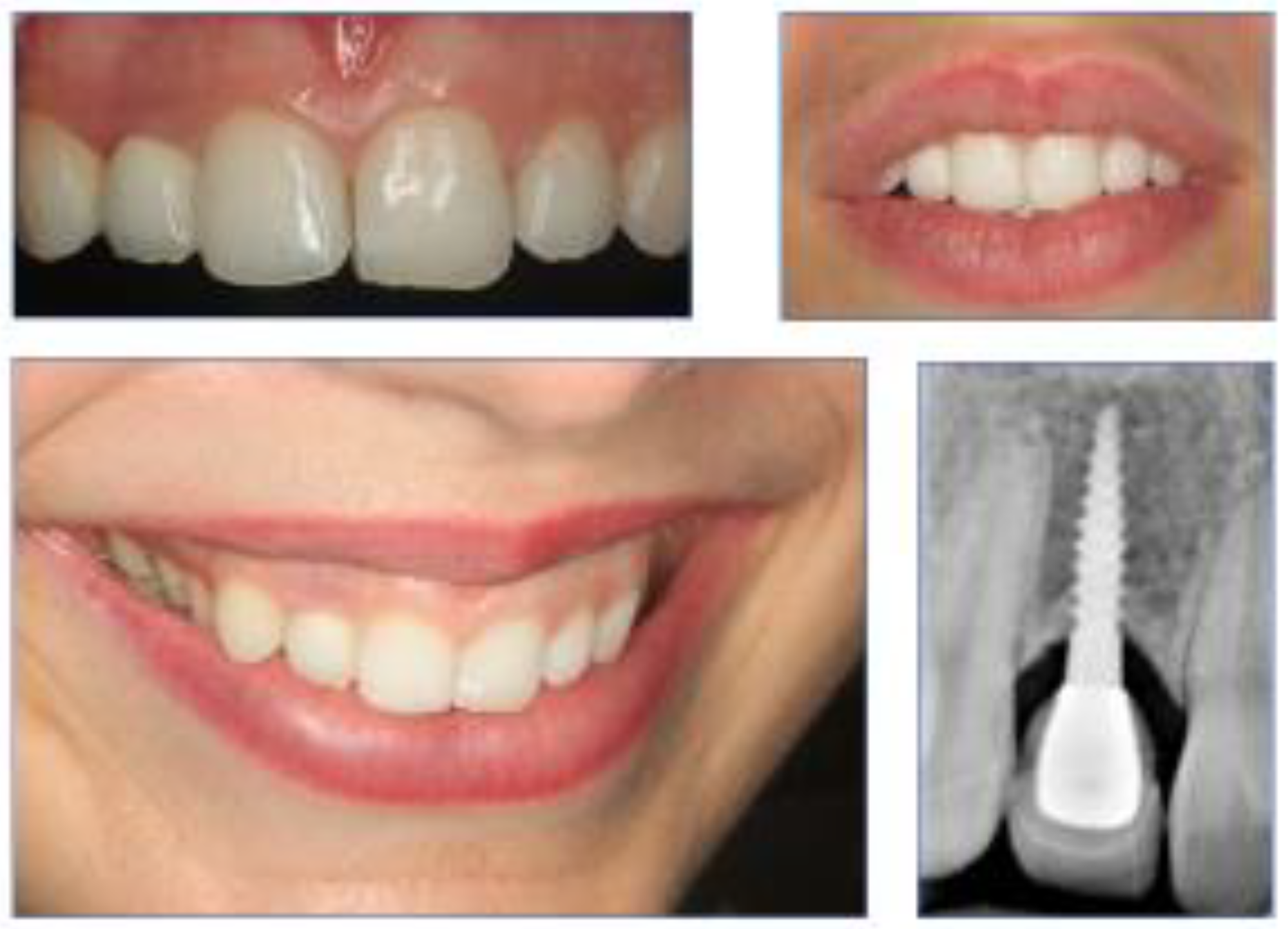 Applsci 12 03808 g005