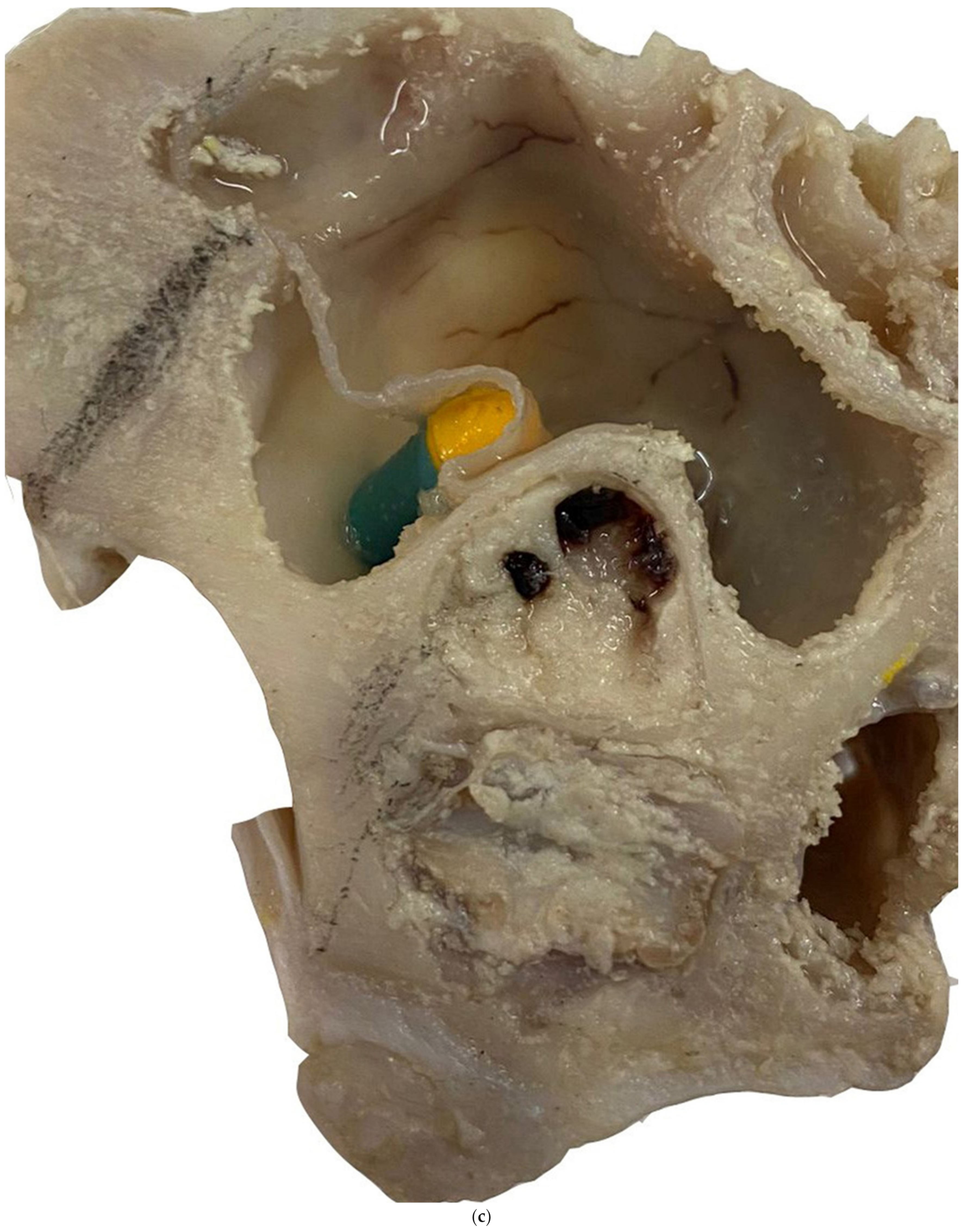 Applsci 12 04406 g001c