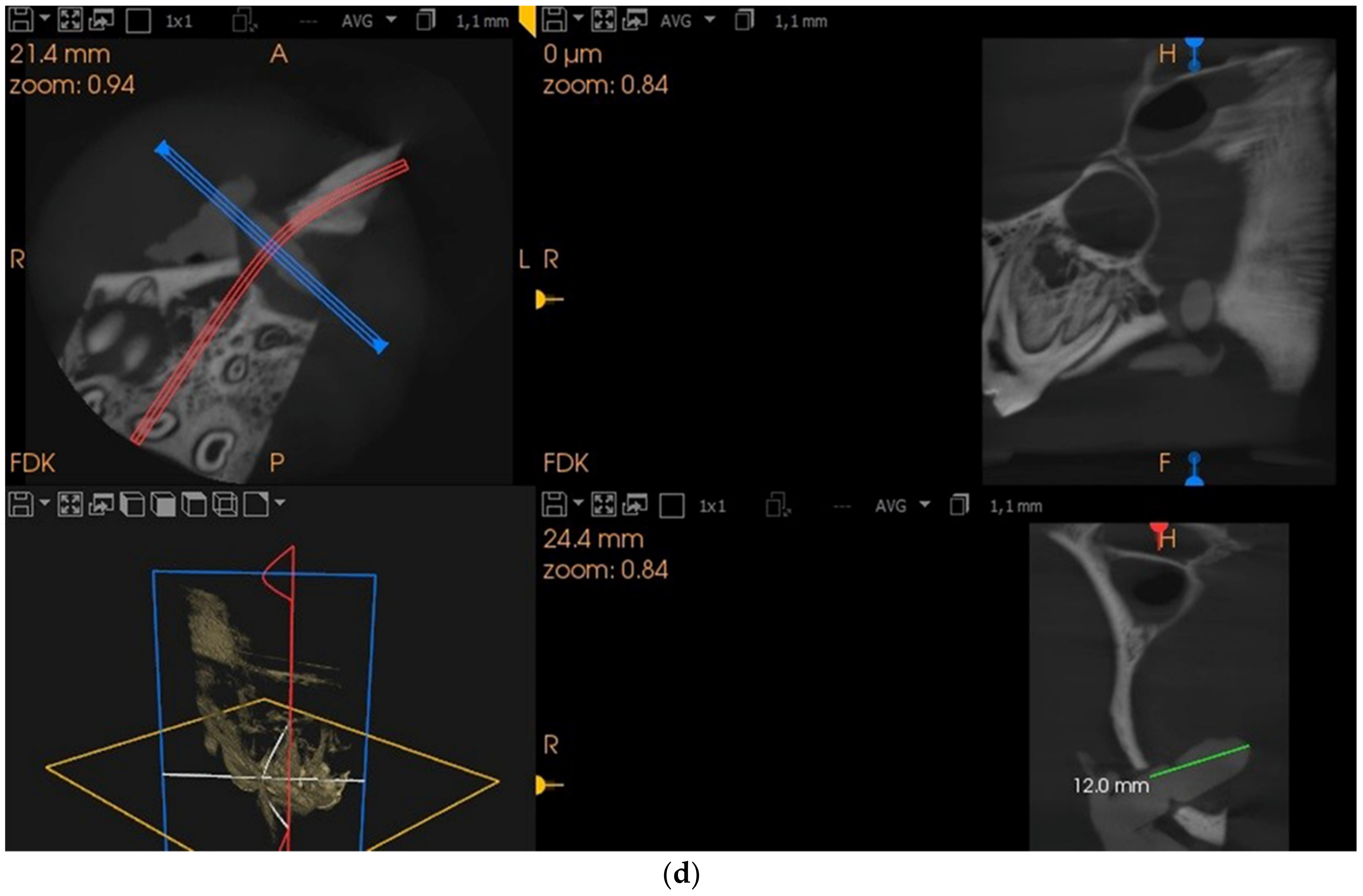 Applsci 12 04406 g001d