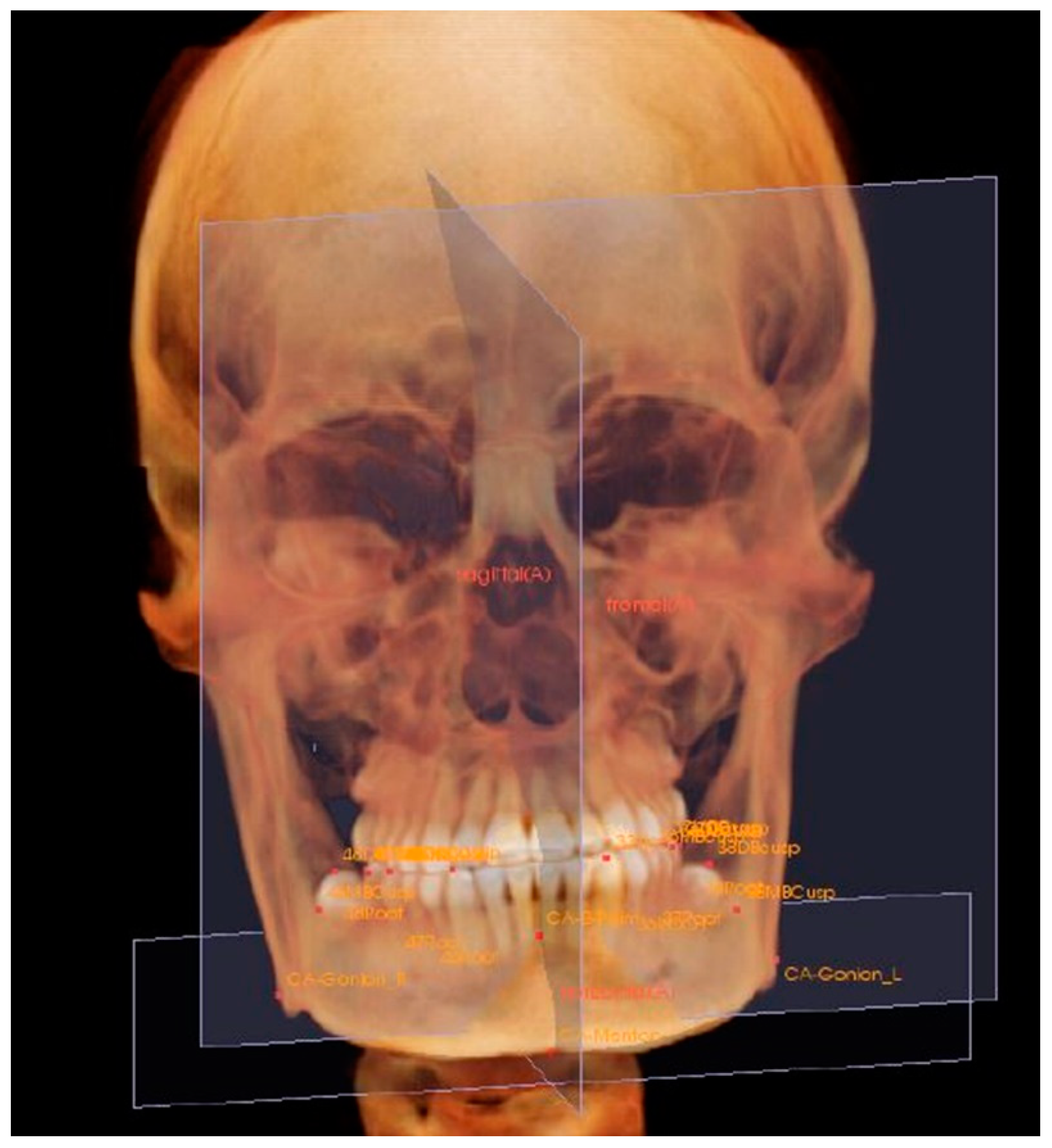 Applsci 12 04613 g002