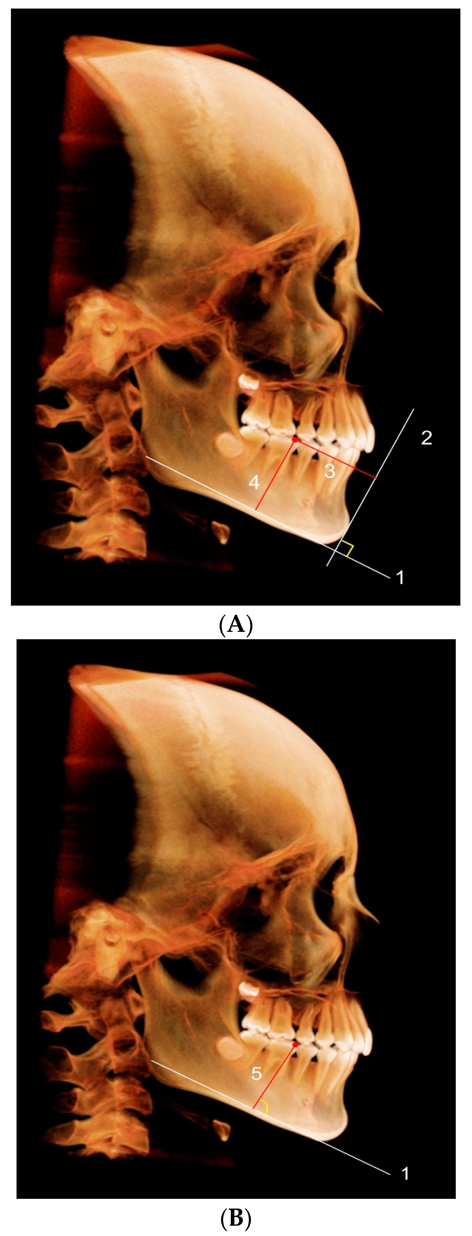 Applsci 12 04613 g003a