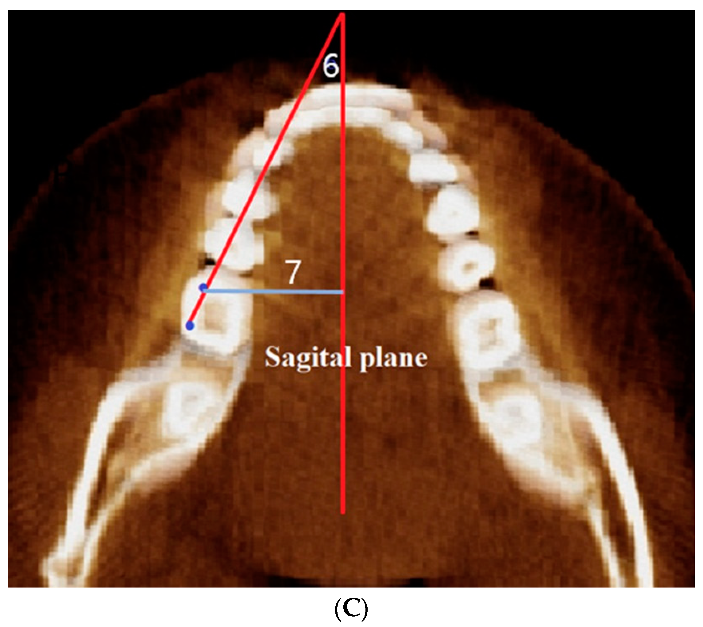 Applsci 12 04613 g003b