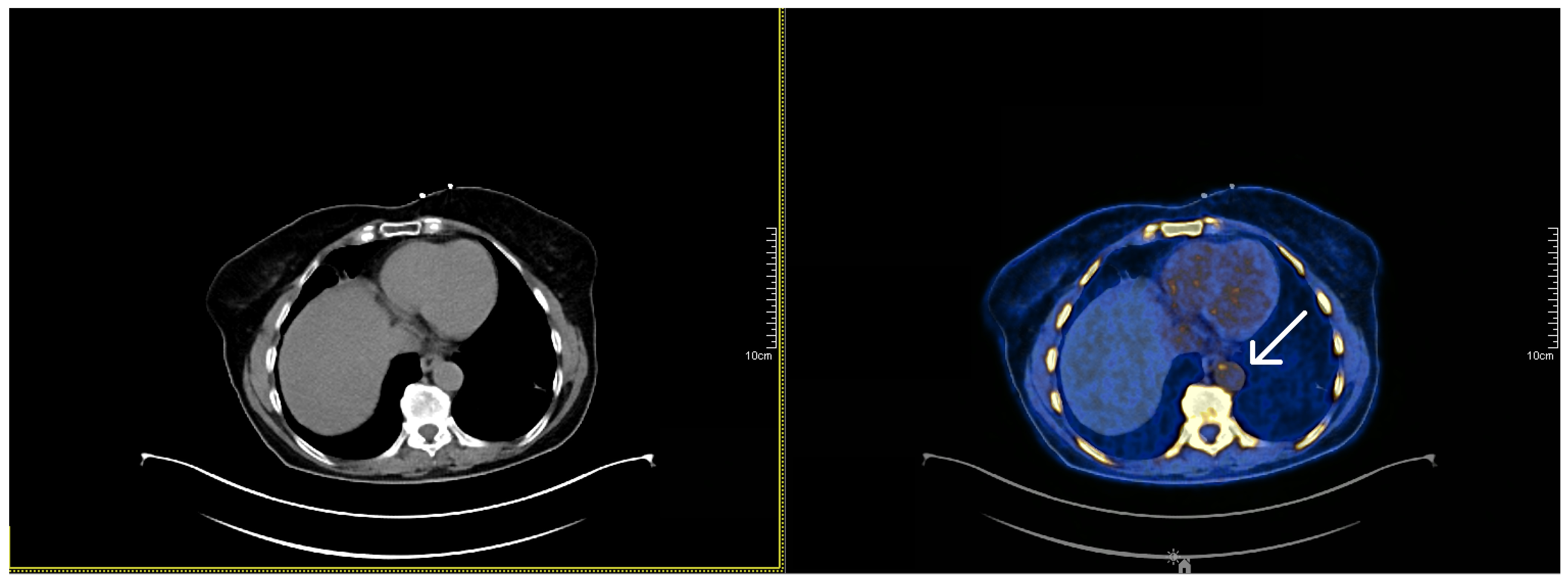 Applsci 12 04704 g001