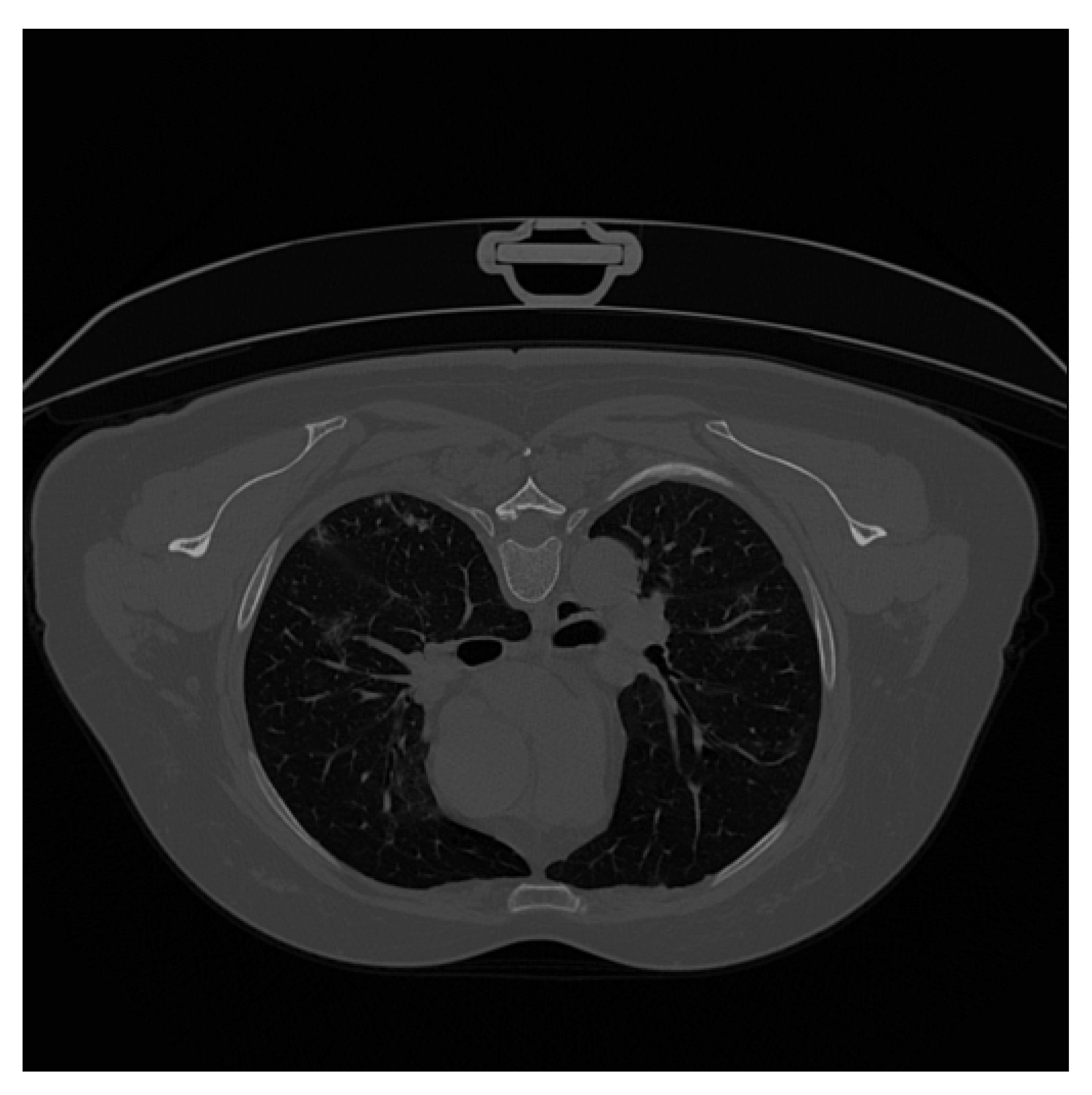 Applsci 12 04825 i001