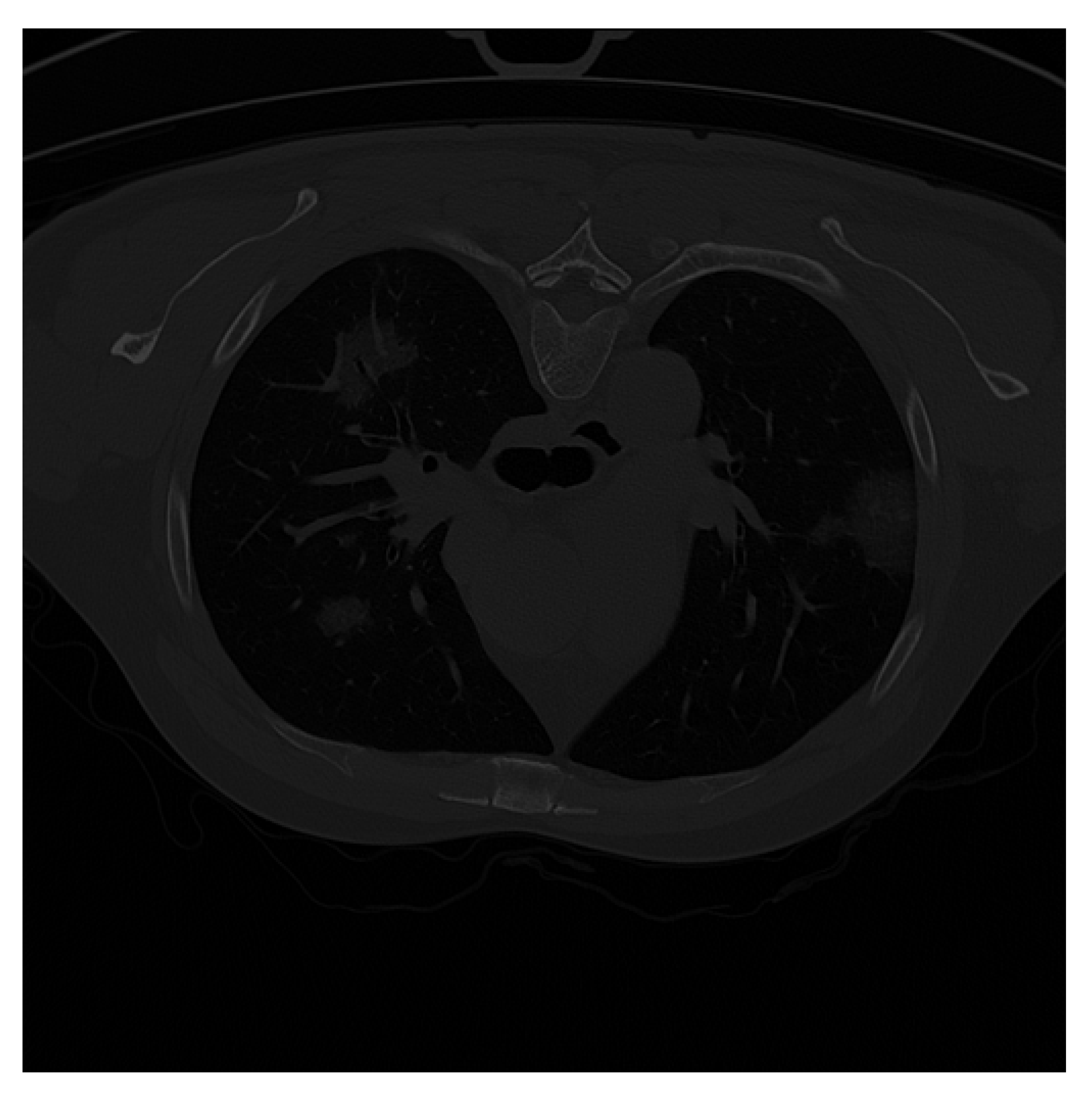 Applsci 12 04825 i005