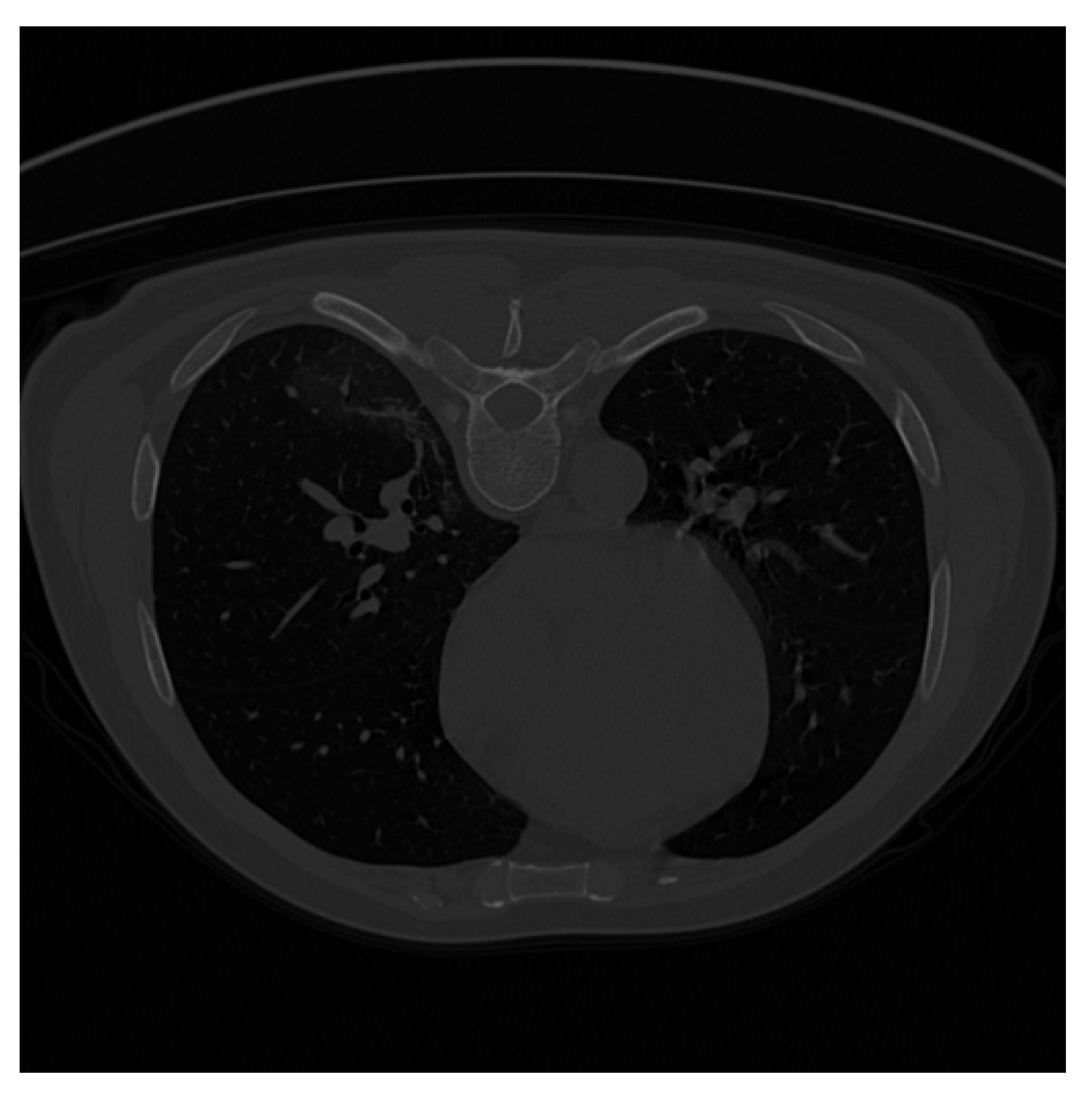 Applsci 12 04825 i009