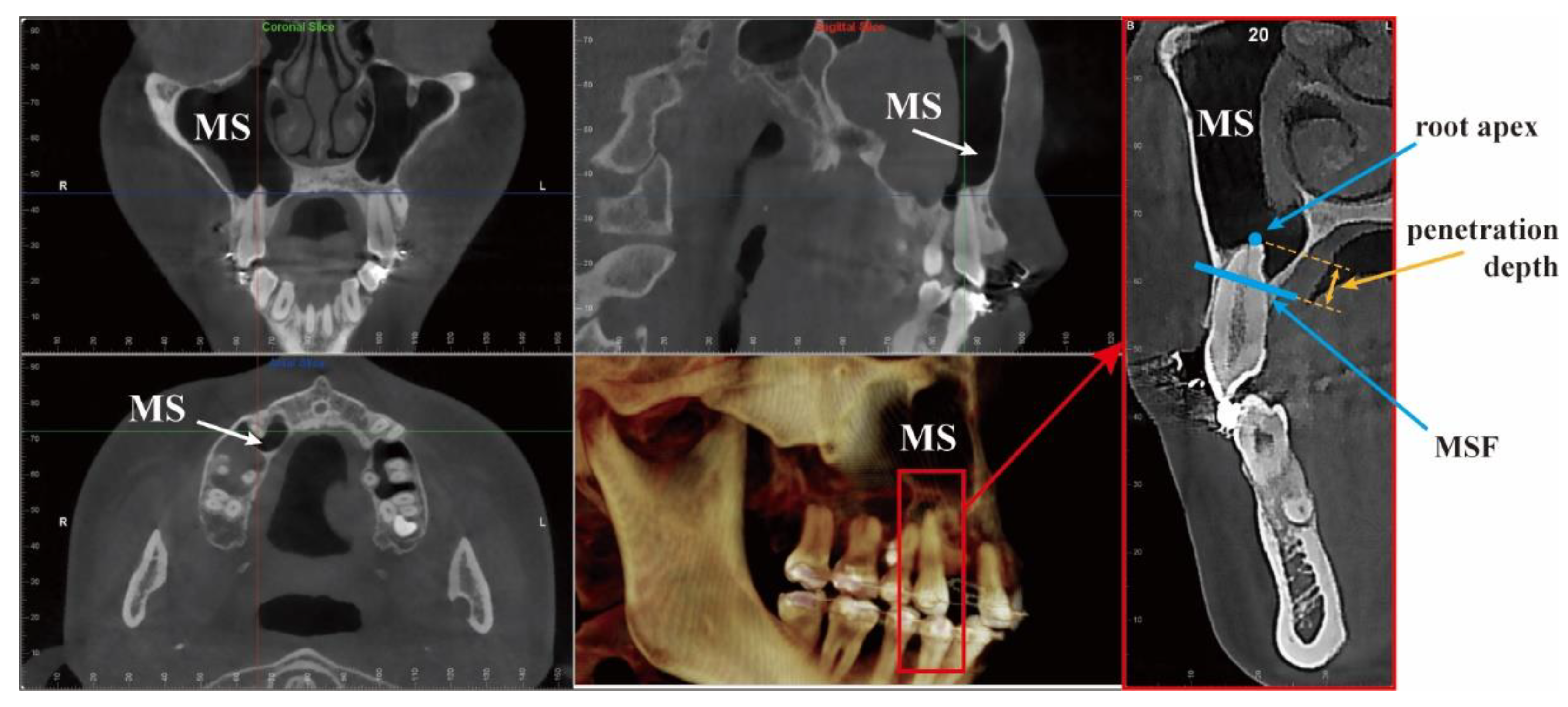 Applsci 12 04990 g001