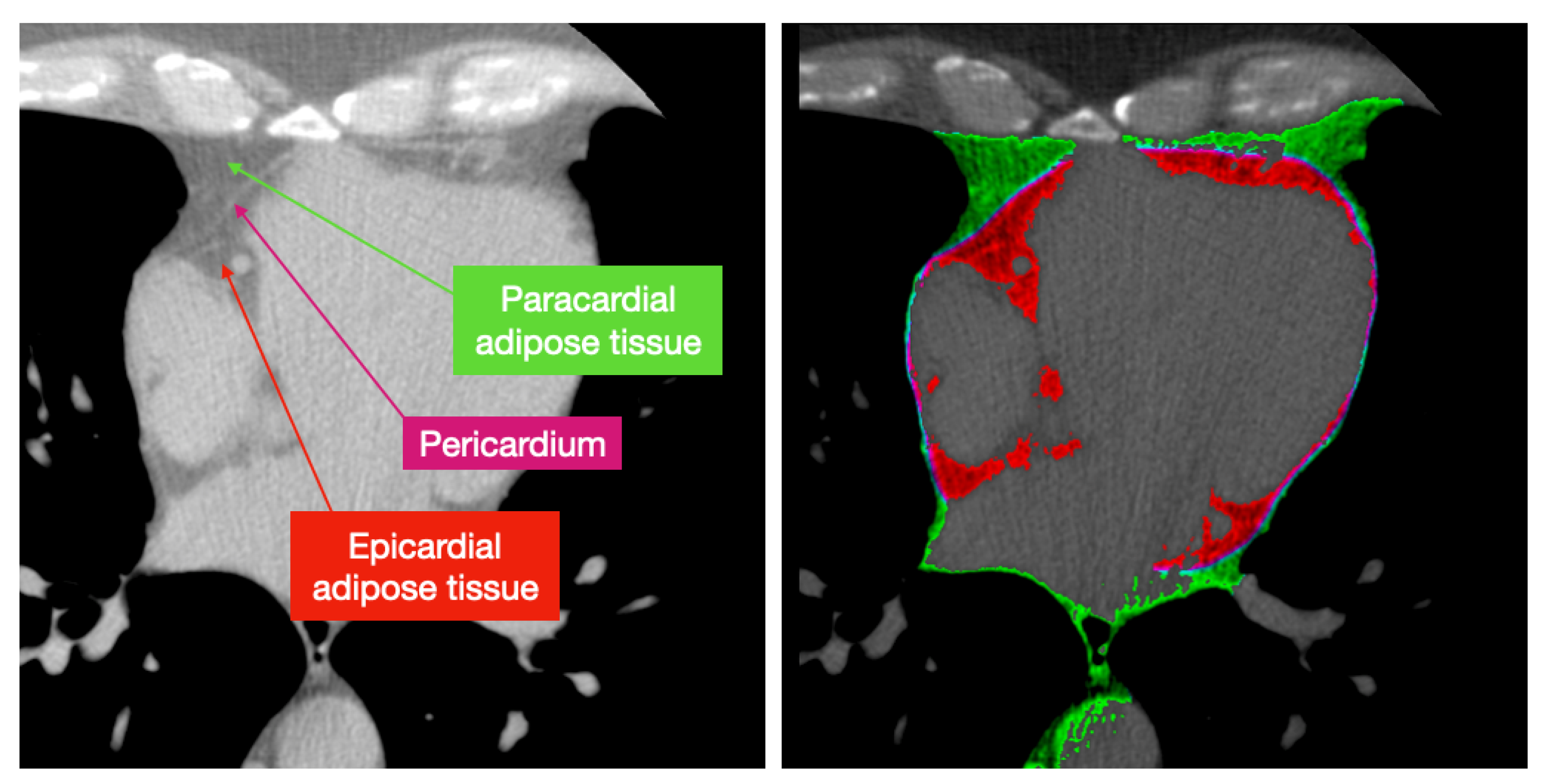 Applsci 12 05217 g003