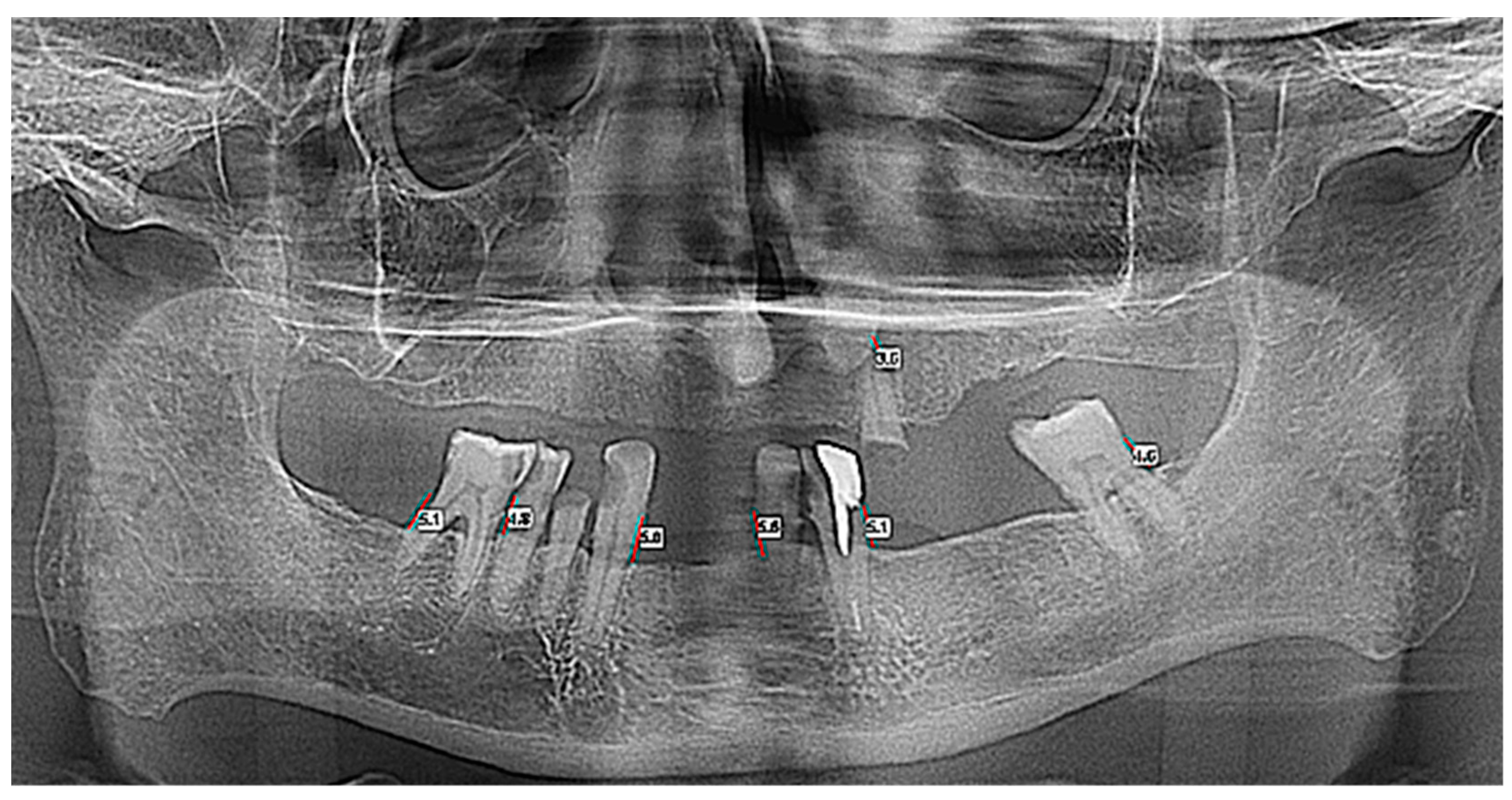 Applsci 12 05235 g001